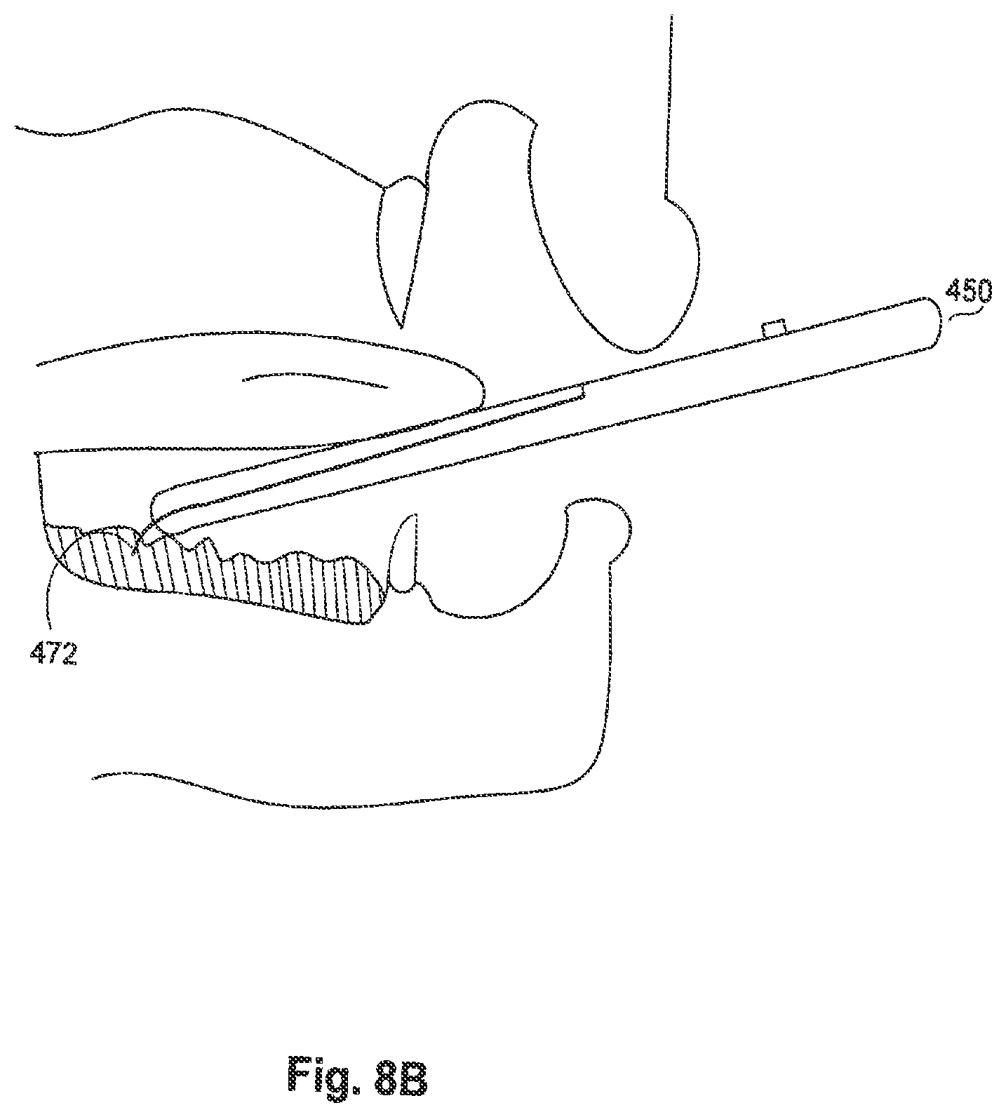 Patent US12303292 Figure 11 – Method and apparatus for health condition related to the skin of a person