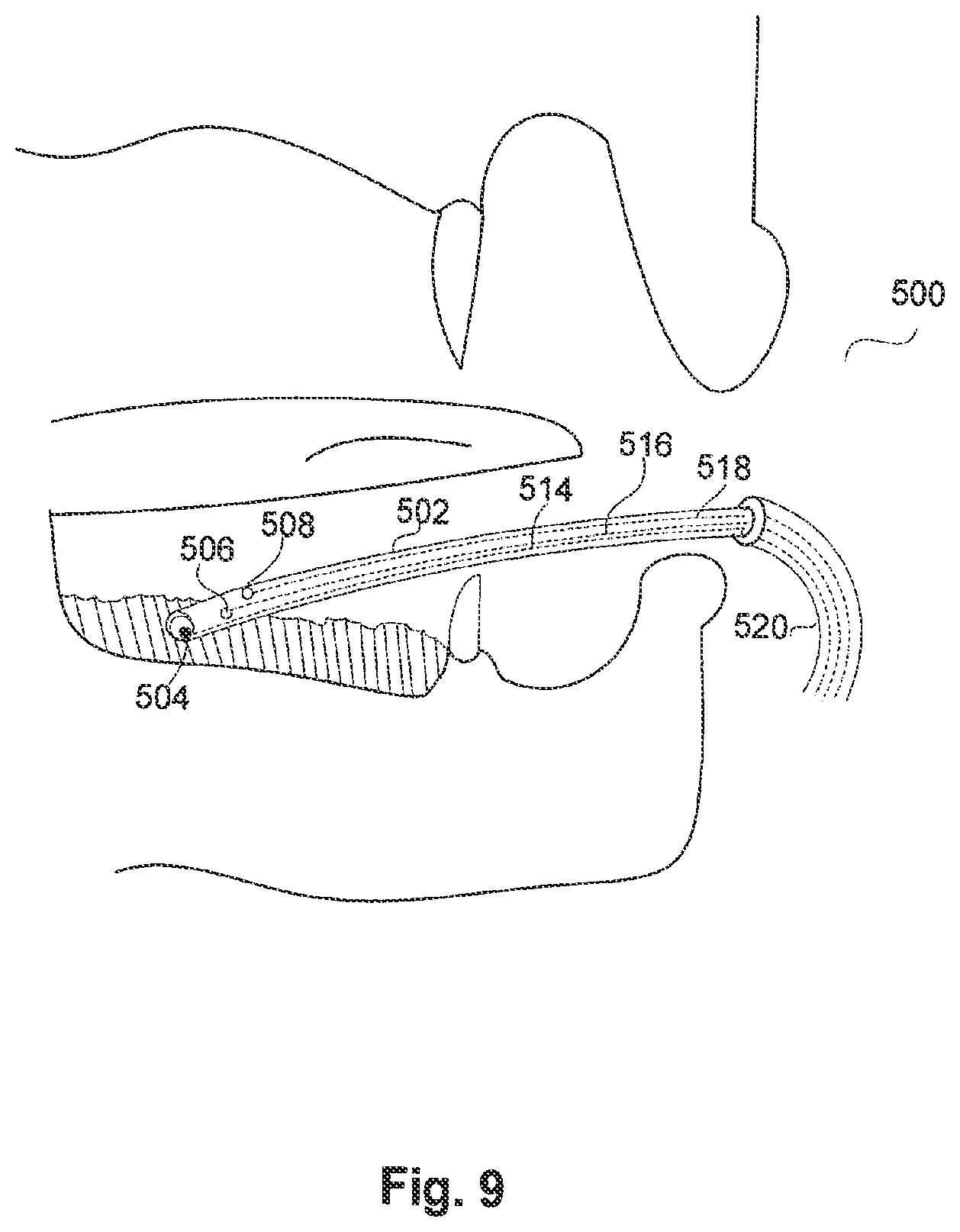 Patent US12303292 Figure 12 – Method and apparatus for health condition related to the skin of a person