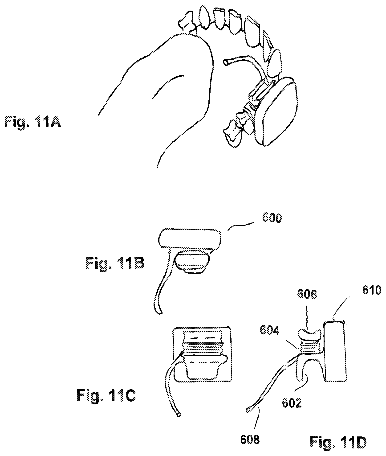 Patent US12303292 Figure 14 – Method and apparatus for health condition related to the skin of a person