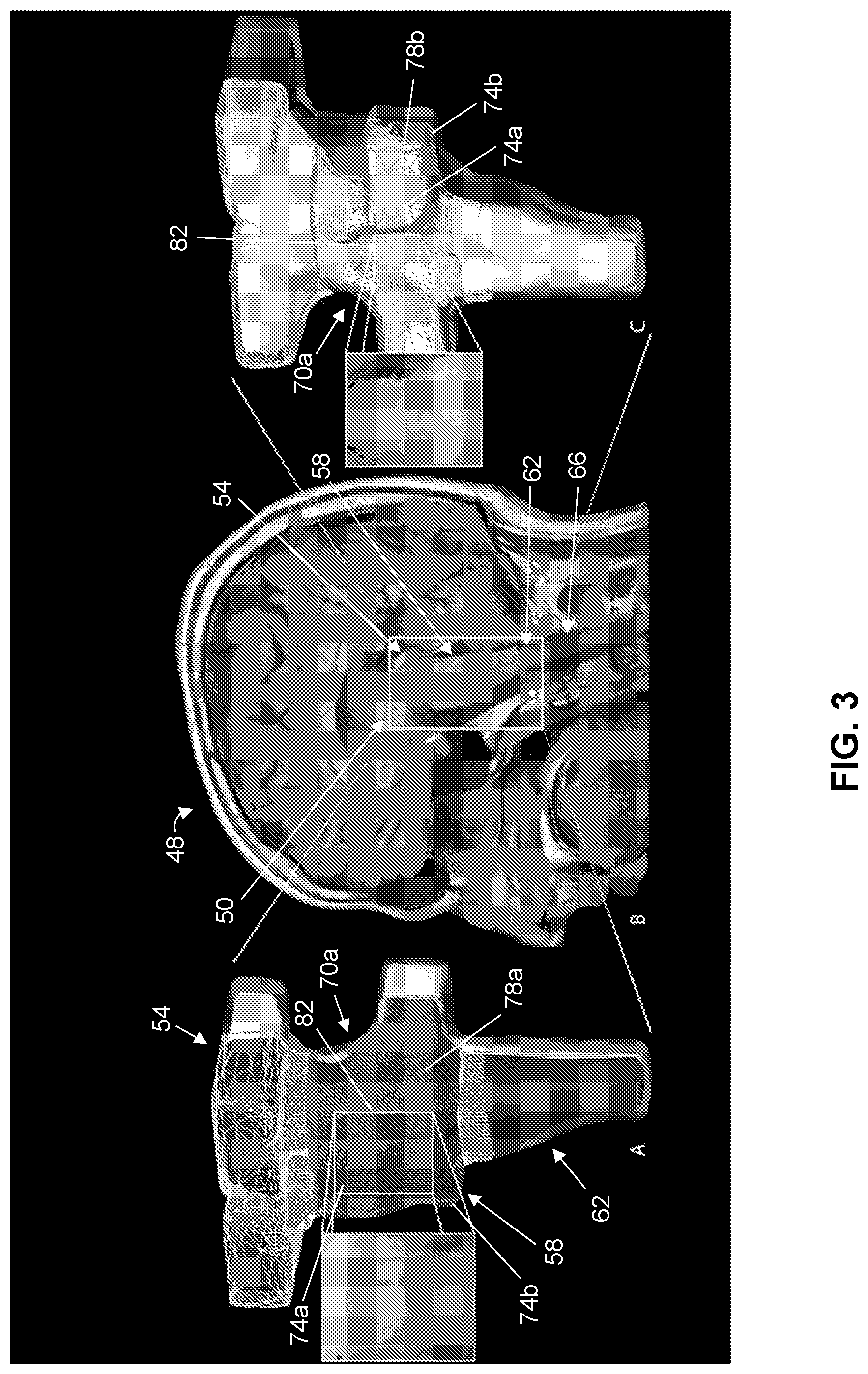 Patent US12303298 Figure 3 – Methods and systems for analyzing a central nervous system based on brainstem structural characteristics
