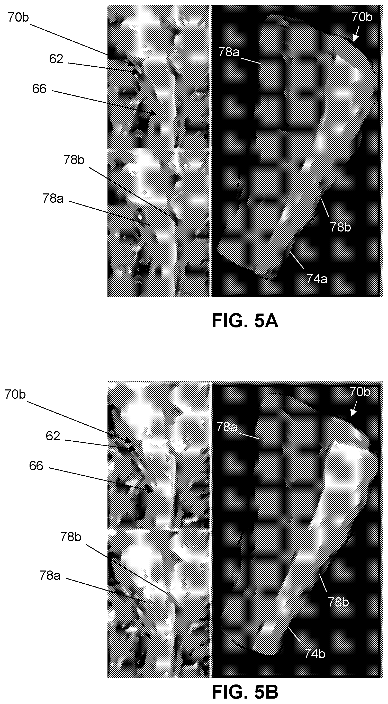 Patent US12303298 Figure 5 – Methods and systems for analyzing a central nervous system based on brainstem structural characteristics