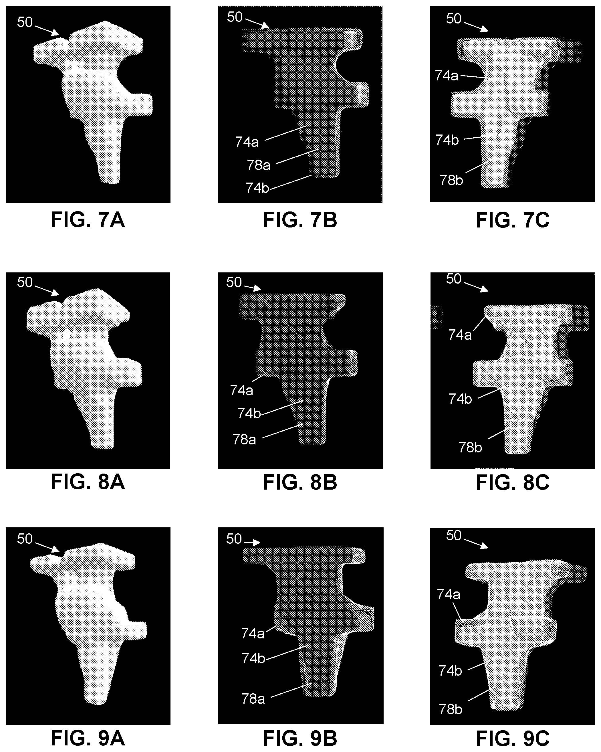 Patent US12303298 Figure 8 – Methods and systems for analyzing a central nervous system based on brainstem structural characteristics