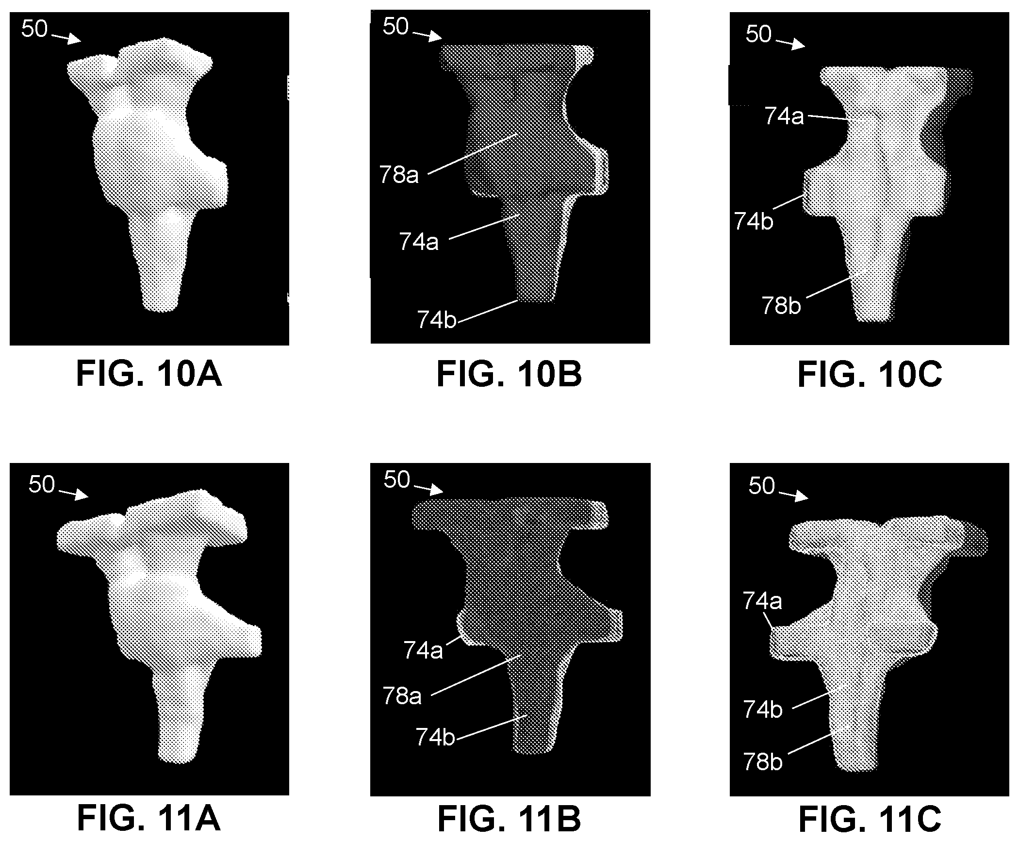 Patent US12303298 Figure 9 – Methods and systems for analyzing a central nervous system based on brainstem structural characteristics