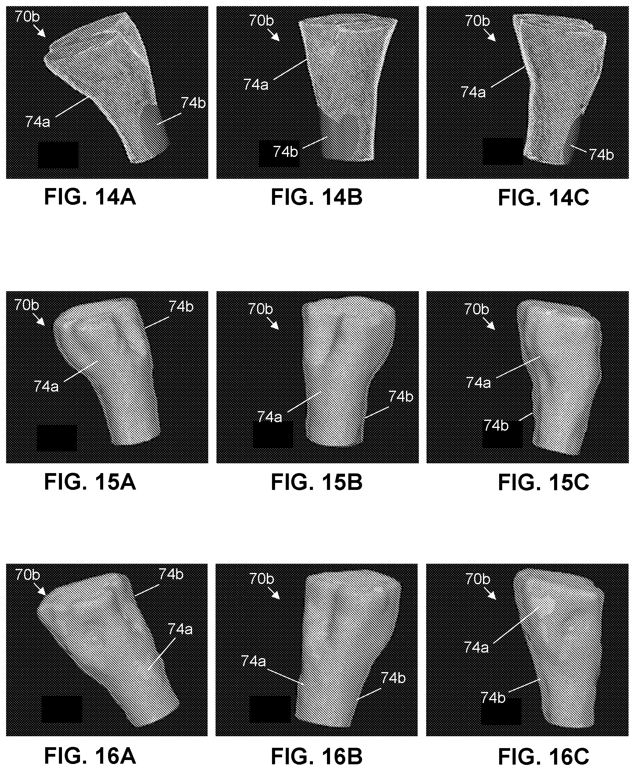 Patent US12303298 Figure 12 – Methods and systems for analyzing a central nervous system based on brainstem structural characteristics