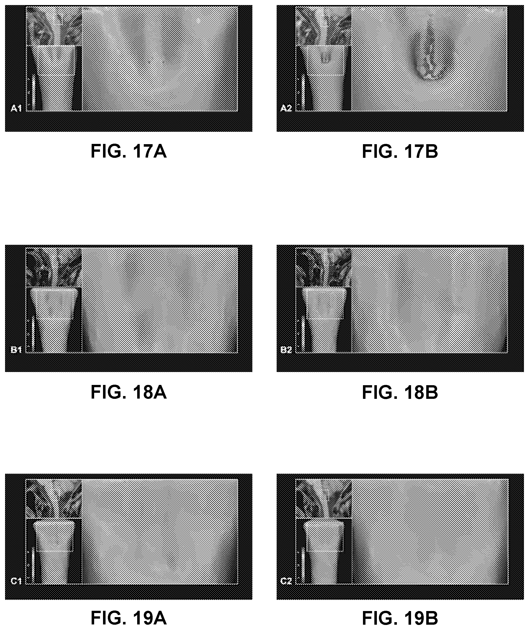 Patent US12303298 Figure 13 – Methods and systems for analyzing a central nervous system based on brainstem structural characteristics