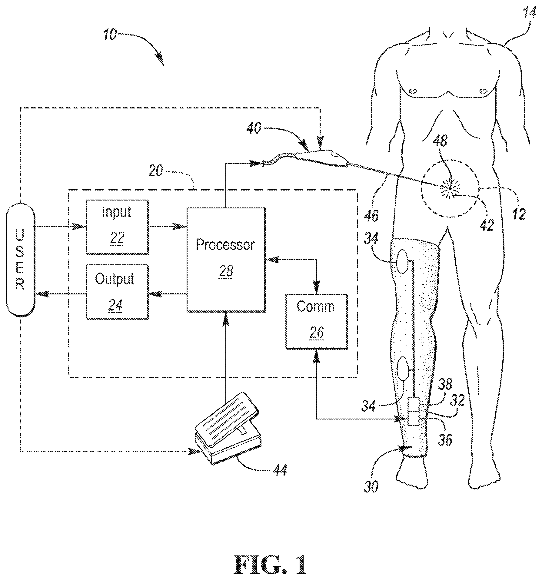 Patent US12303301 Figure 1 – Intraoperative neural monitoring system and method