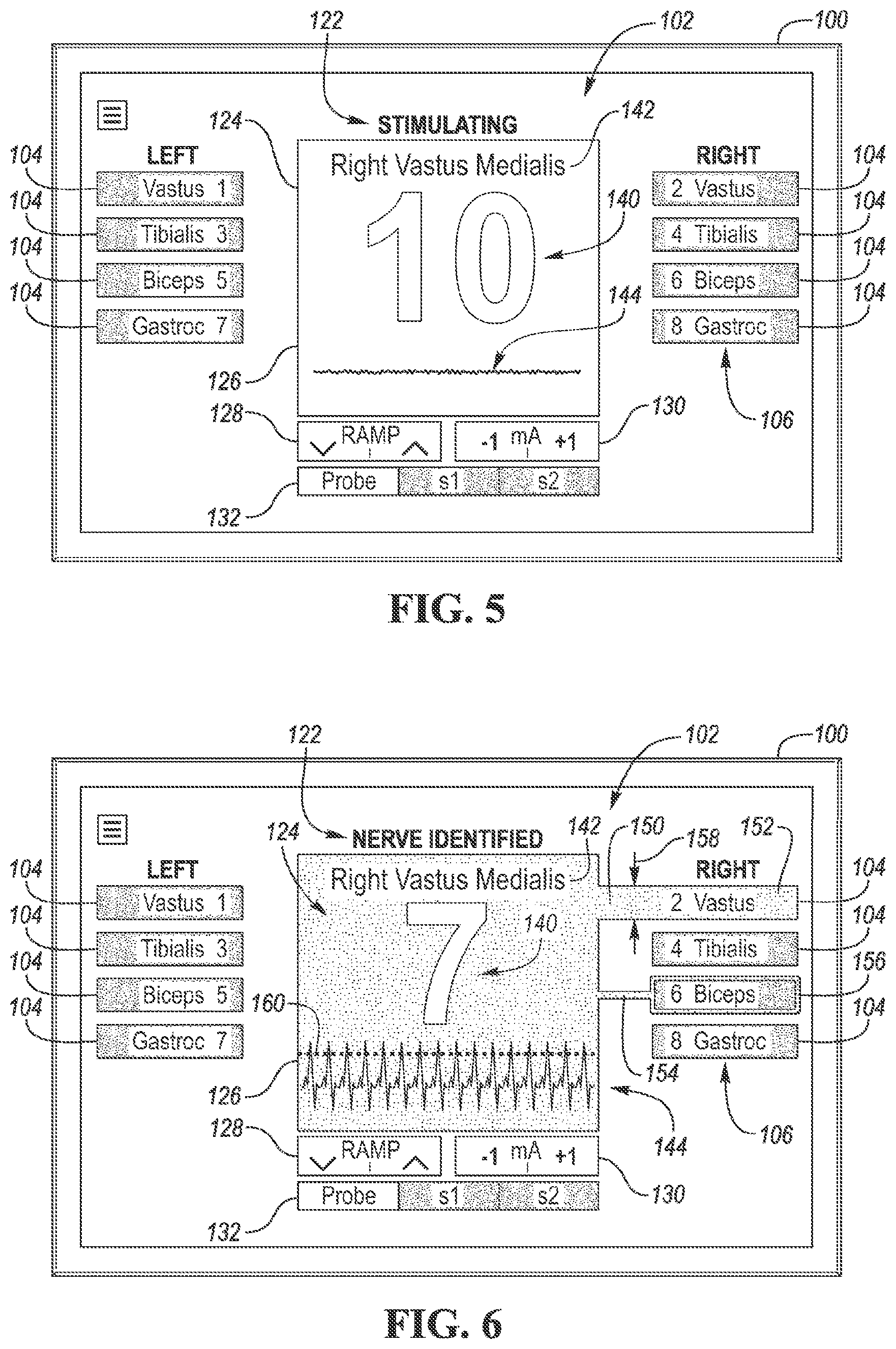 Patent US12303301 Figure 4 – Intraoperative neural monitoring system and method
