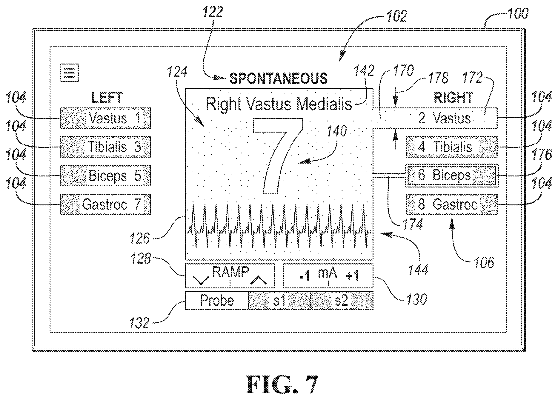 Patent US12303301 Figure 5 – Intraoperative neural monitoring system and method