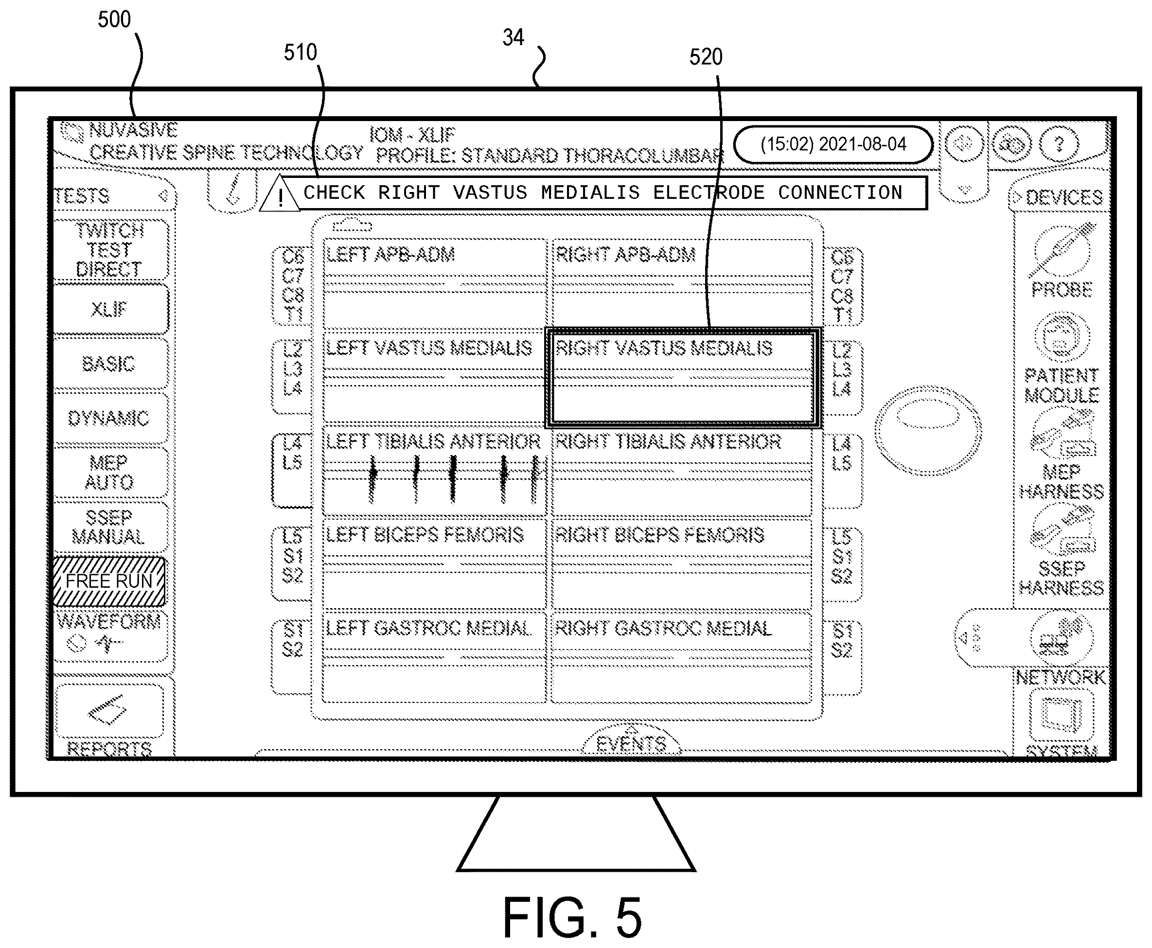 Patent US12303304 Figure 4 – Electrode disconnect detection