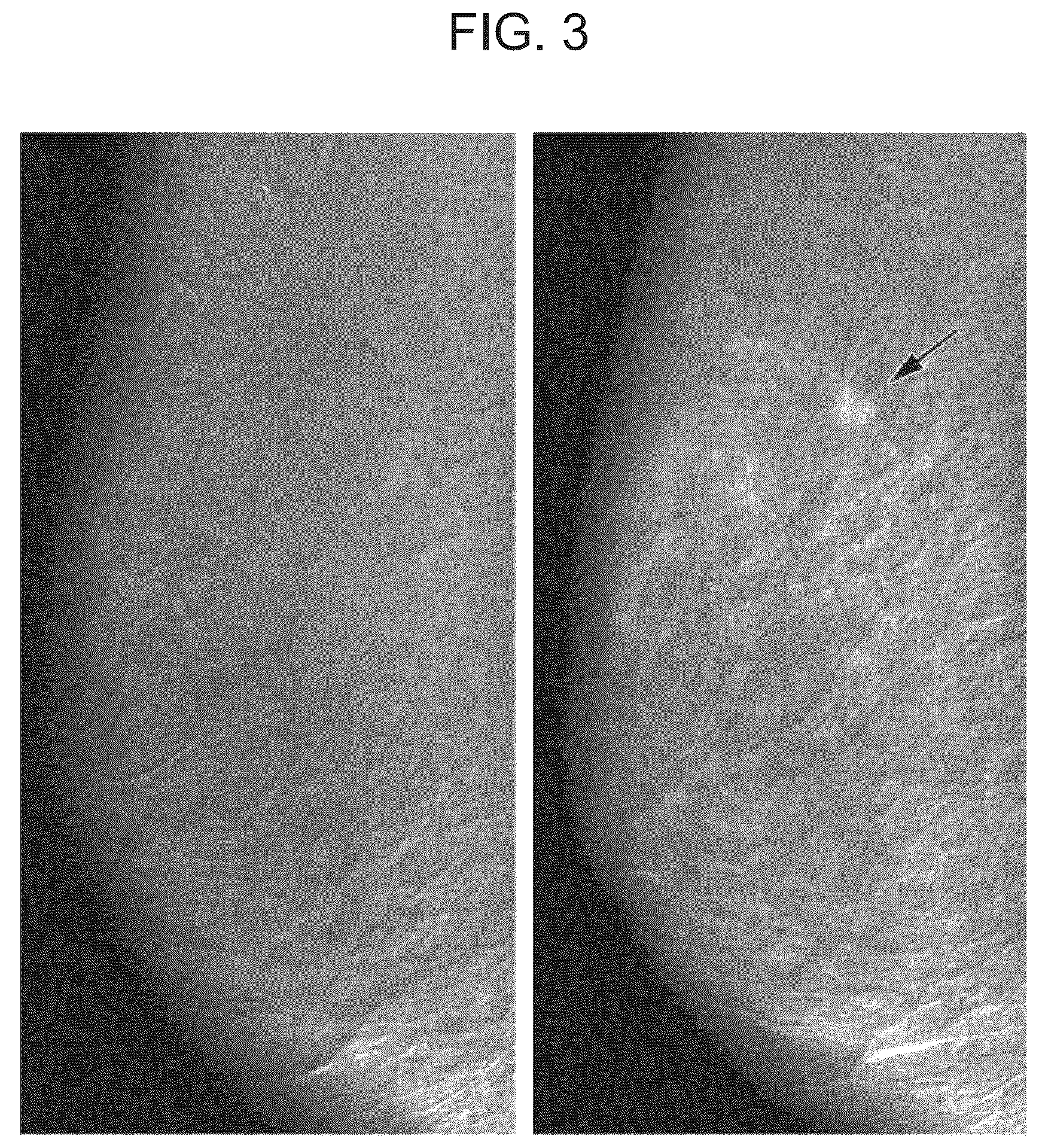 Patent US12303310 Figure 3 – Technology for contrast-enhanced mammography