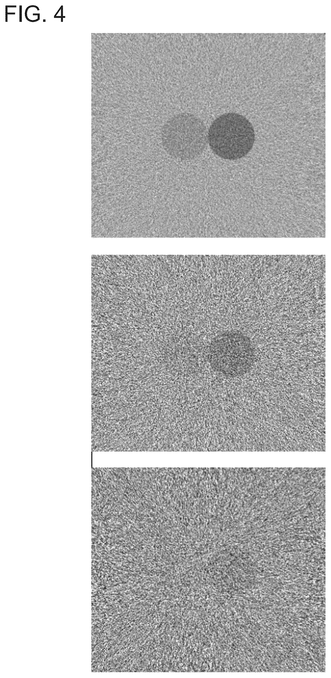 Patent US12303310 Figure 4 – Technology for contrast-enhanced mammography