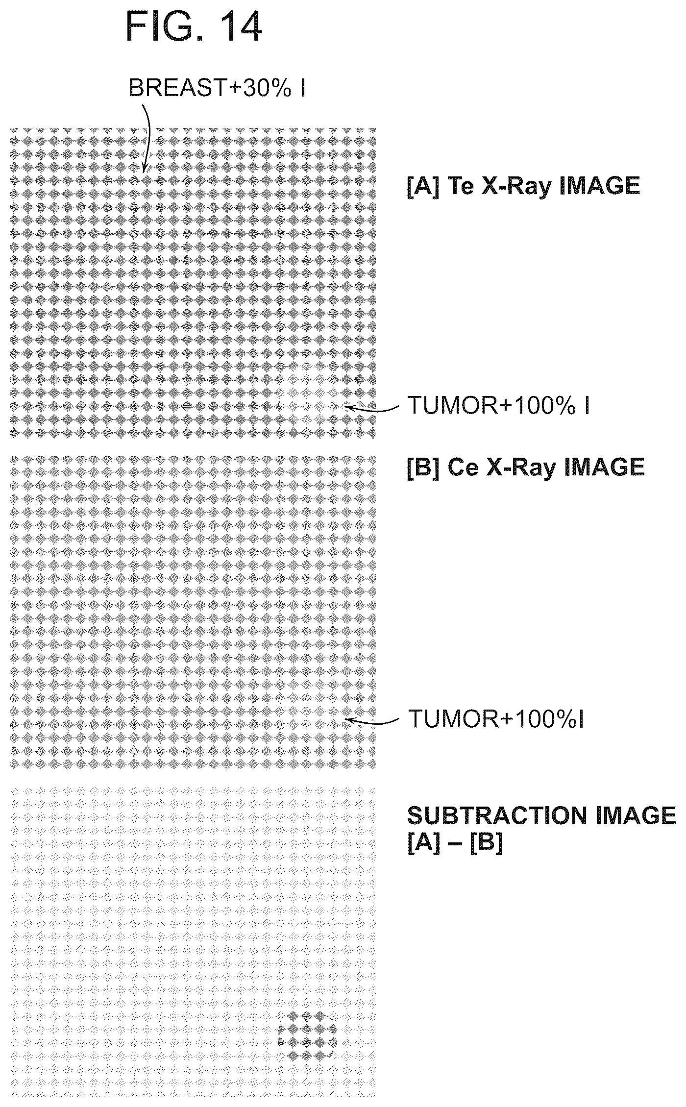 Patent US12303310 Figure 12 – Technology for contrast-enhanced mammography