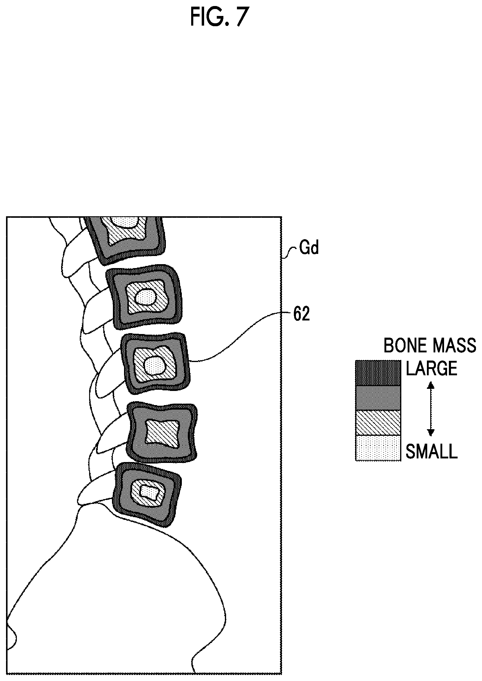 Patent US12303314 Figure 4 – Image processing apparatus, image processing method, and image processing program