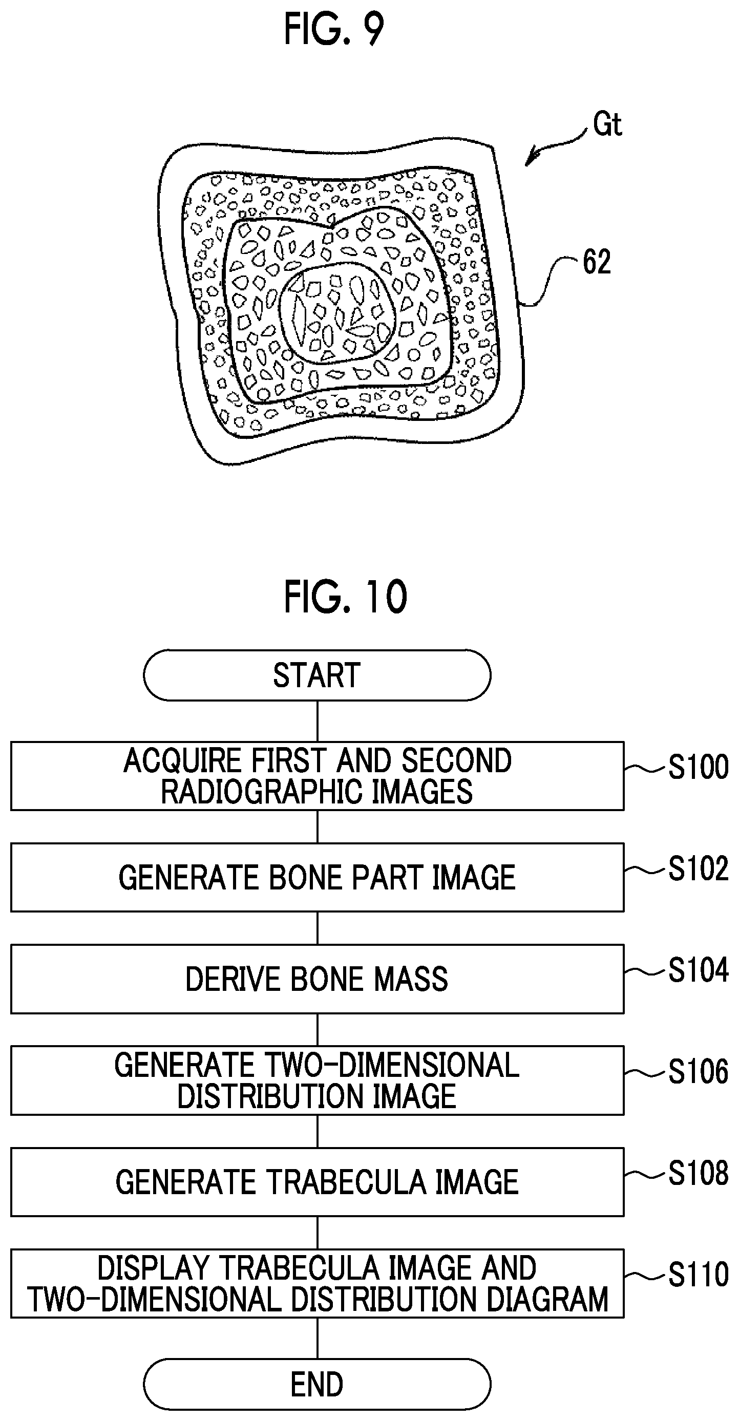 Patent US12303314 Figure 6 – Image processing apparatus, image processing method, and image processing program