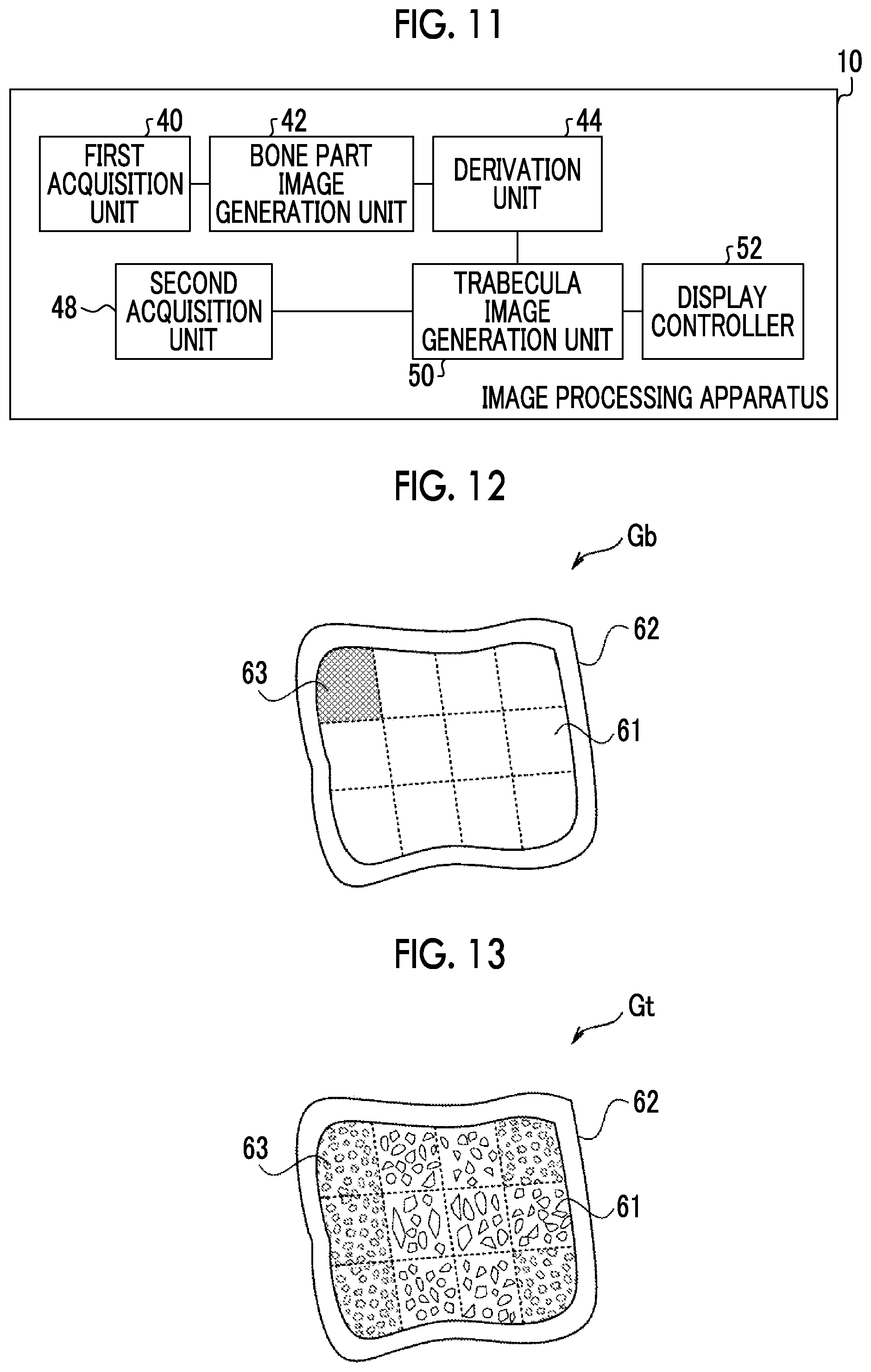 Patent US12303314 Figure 7 – Image processing apparatus, image processing method, and image processing program