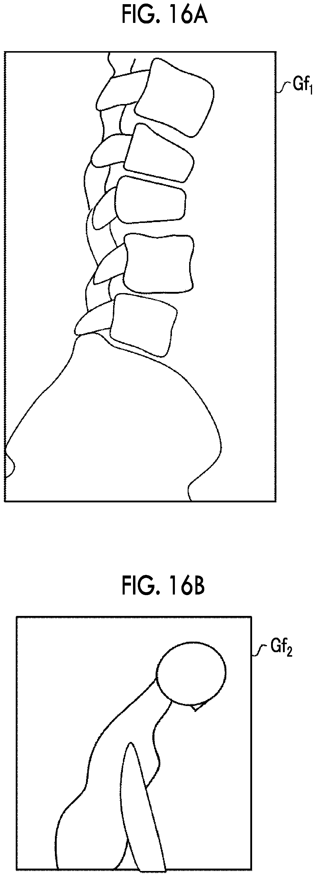 Patent US12303314 Figure 9 – Image processing apparatus, image processing method, and image processing program