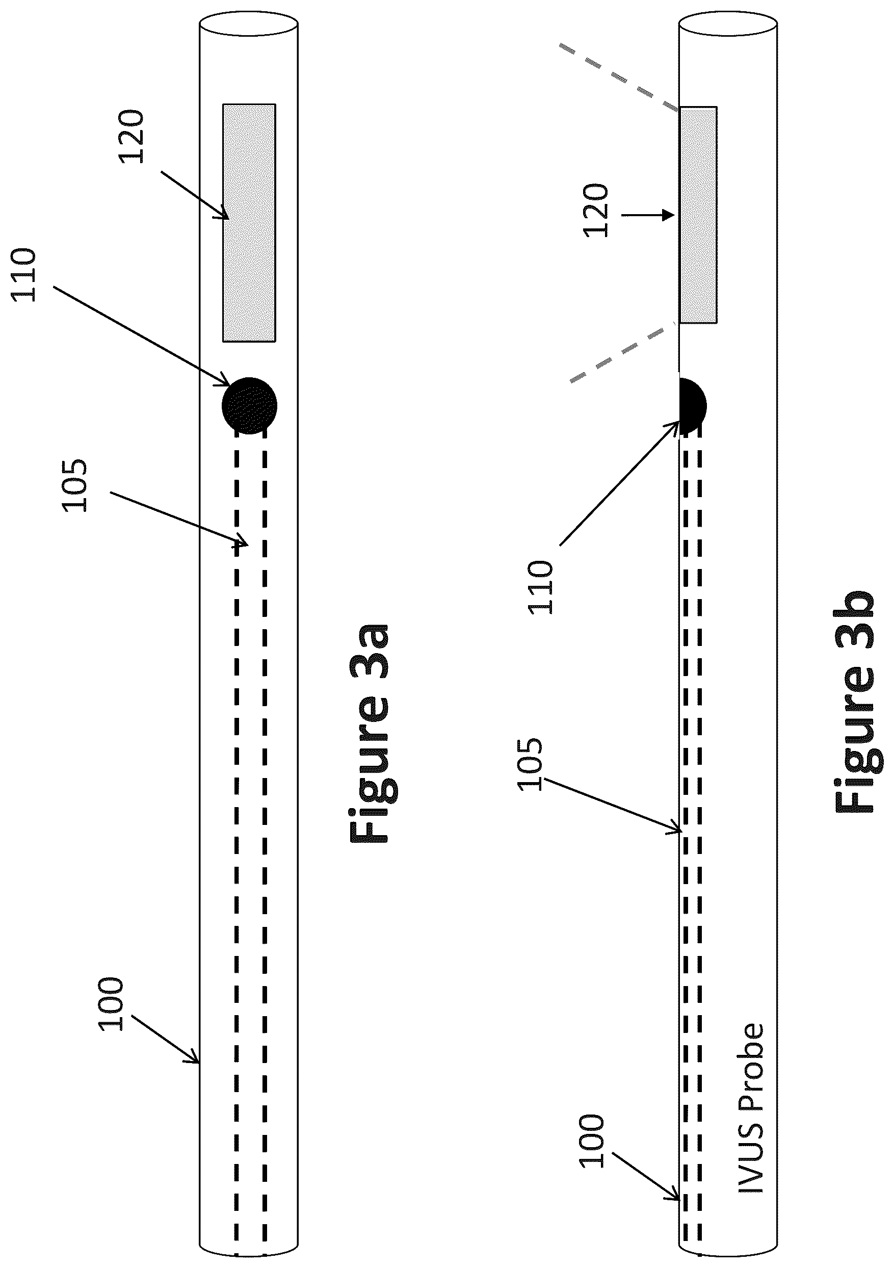 Patent US12303319 Figure 2 – Intravascular ultrasound needle guide