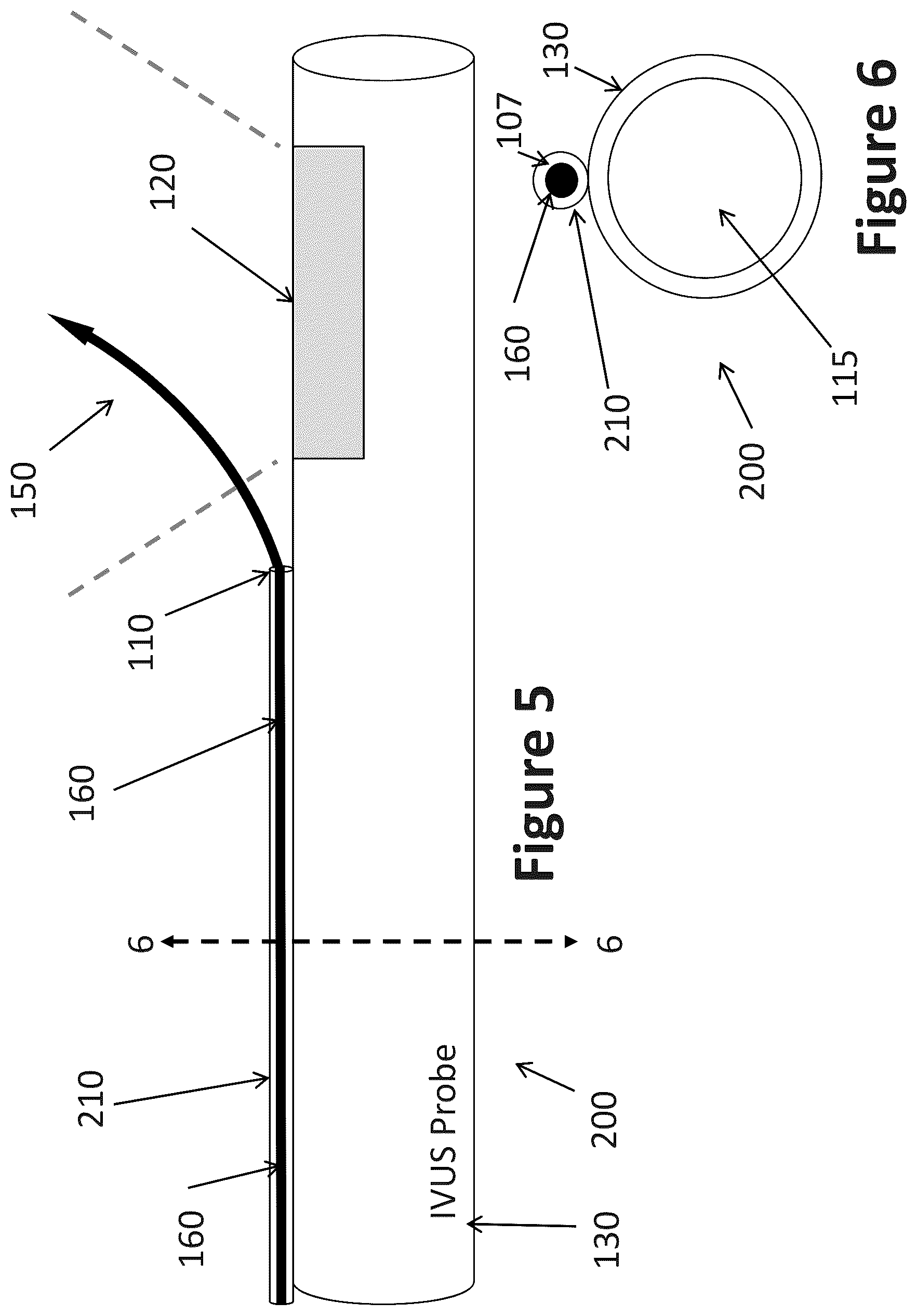 Patent US12303319 Figure 4 – Intravascular ultrasound needle guide