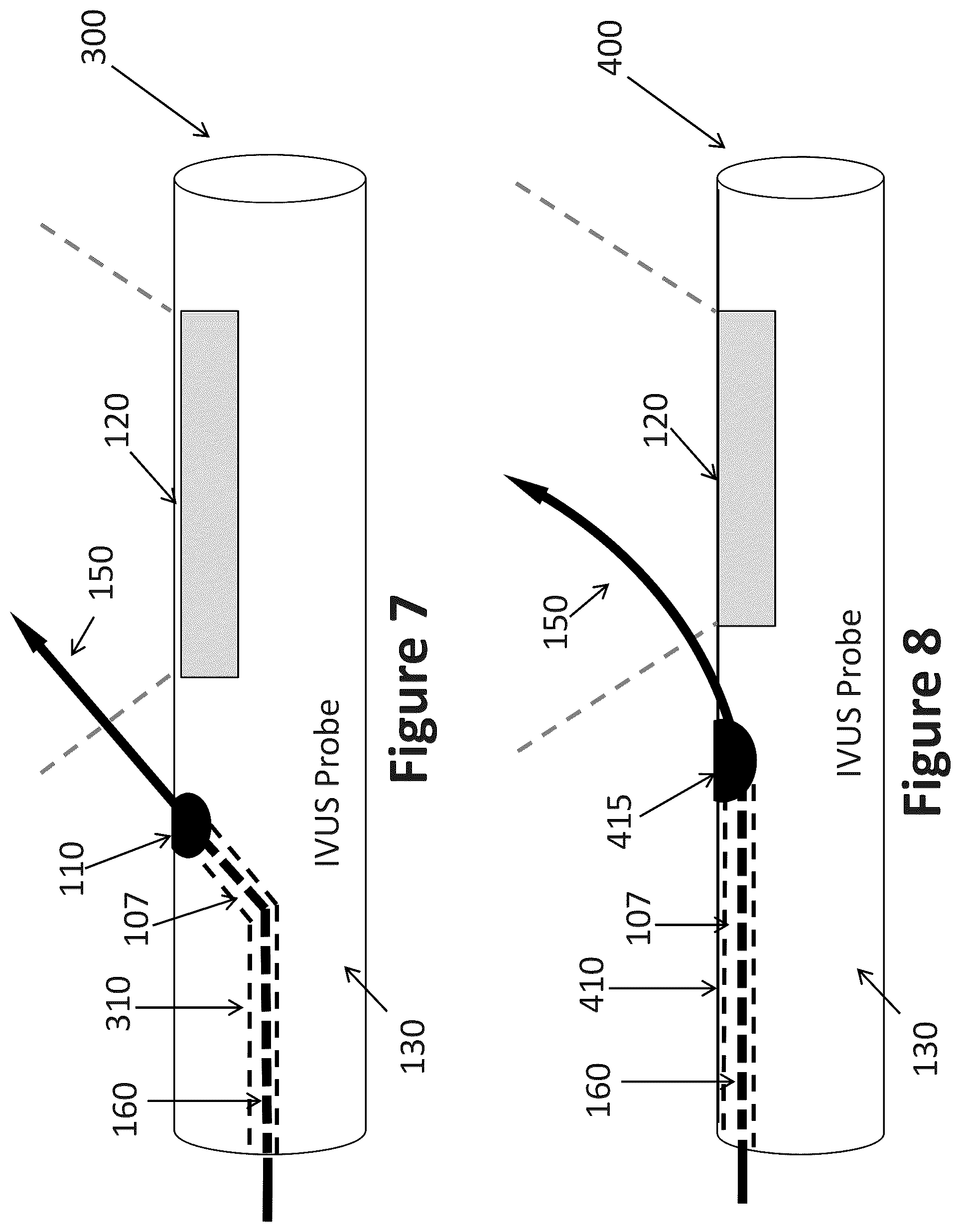 Patent US12303319 Figure 5 – Intravascular ultrasound needle guide