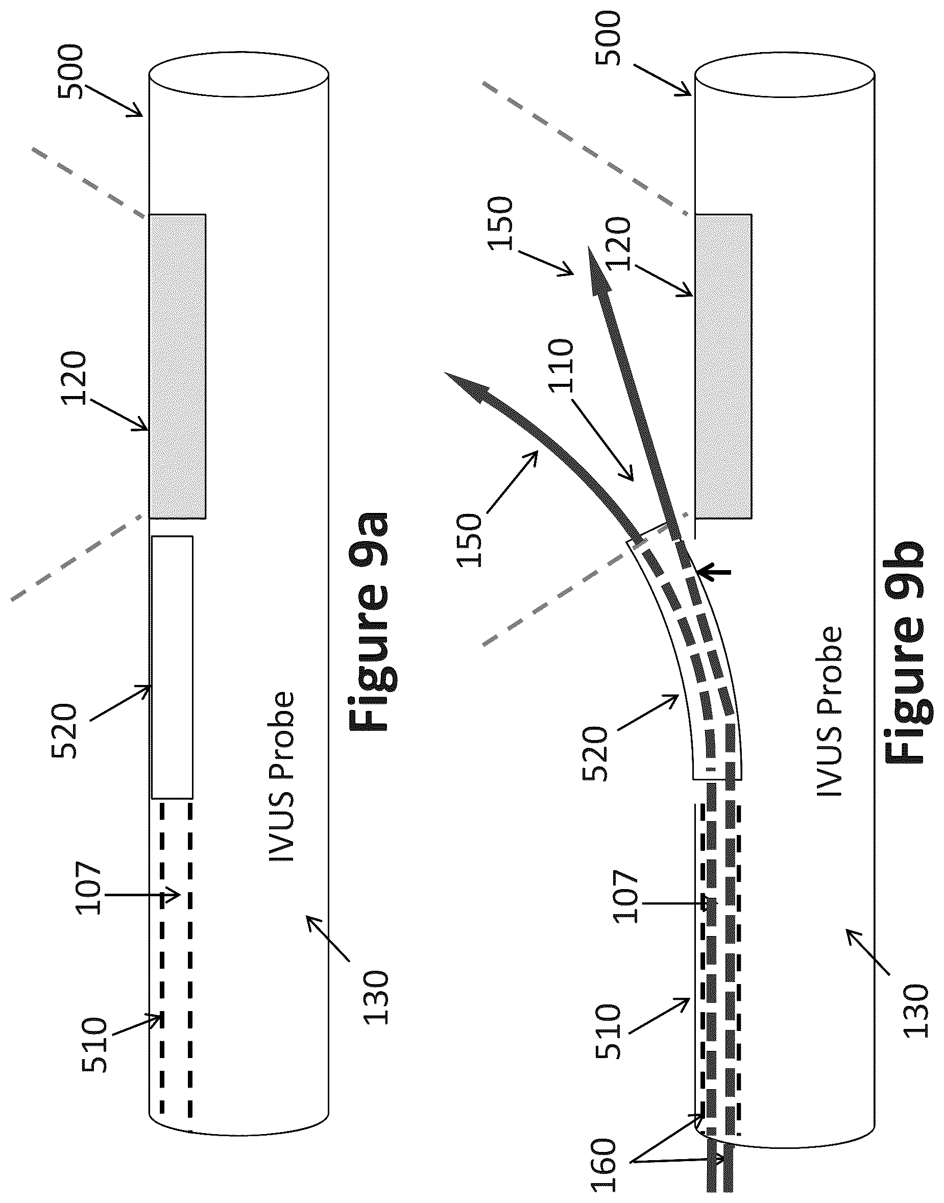 Patent US12303319 Figure 6 – Intravascular ultrasound needle guide