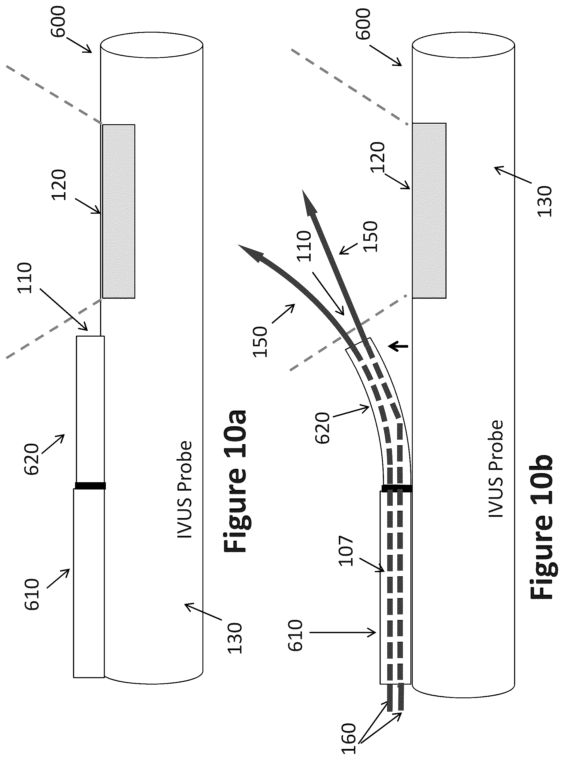 Patent US12303319 Figure 7 – Intravascular ultrasound needle guide