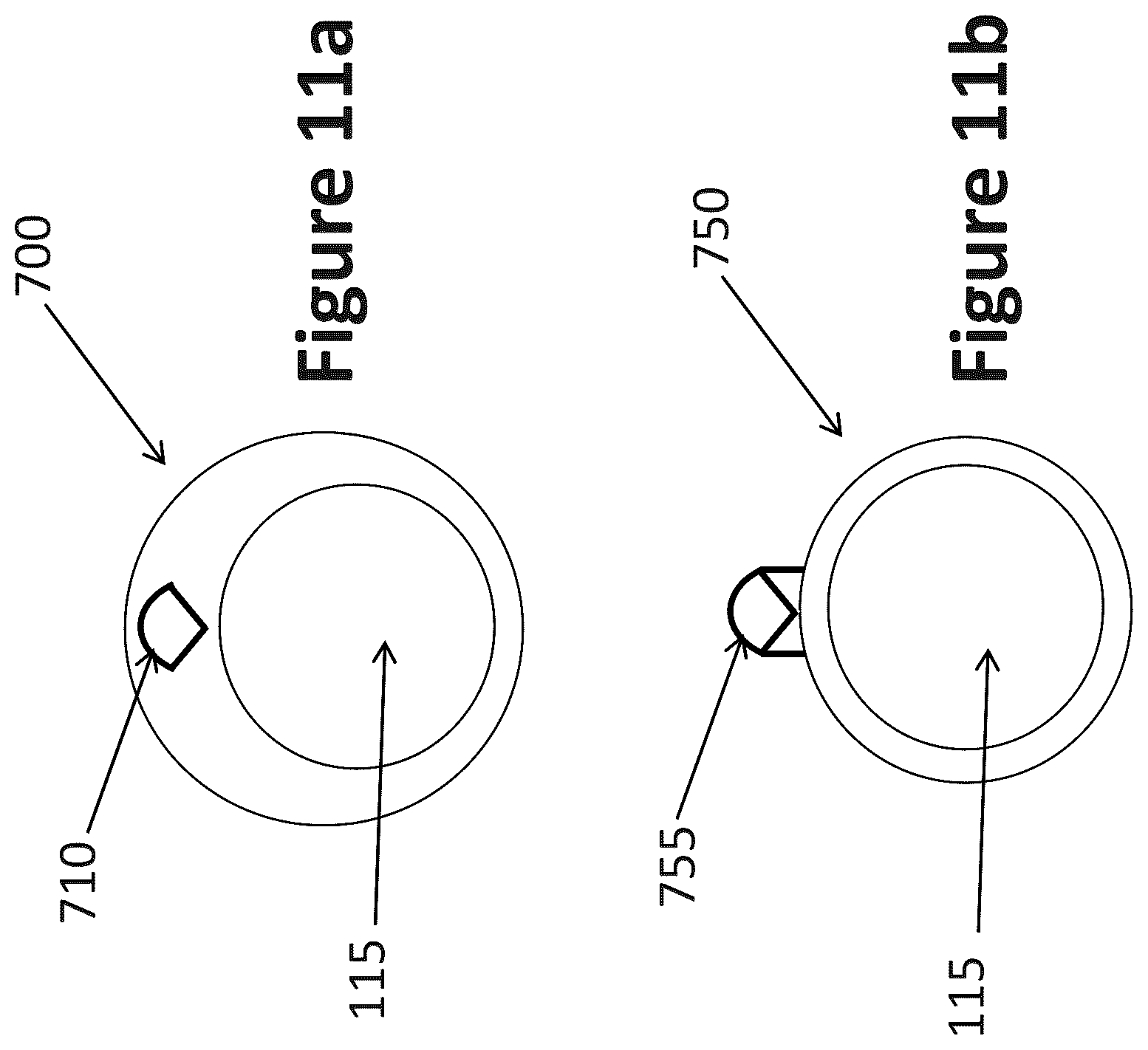 Patent US12303319 Figure 8 – Intravascular ultrasound needle guide
