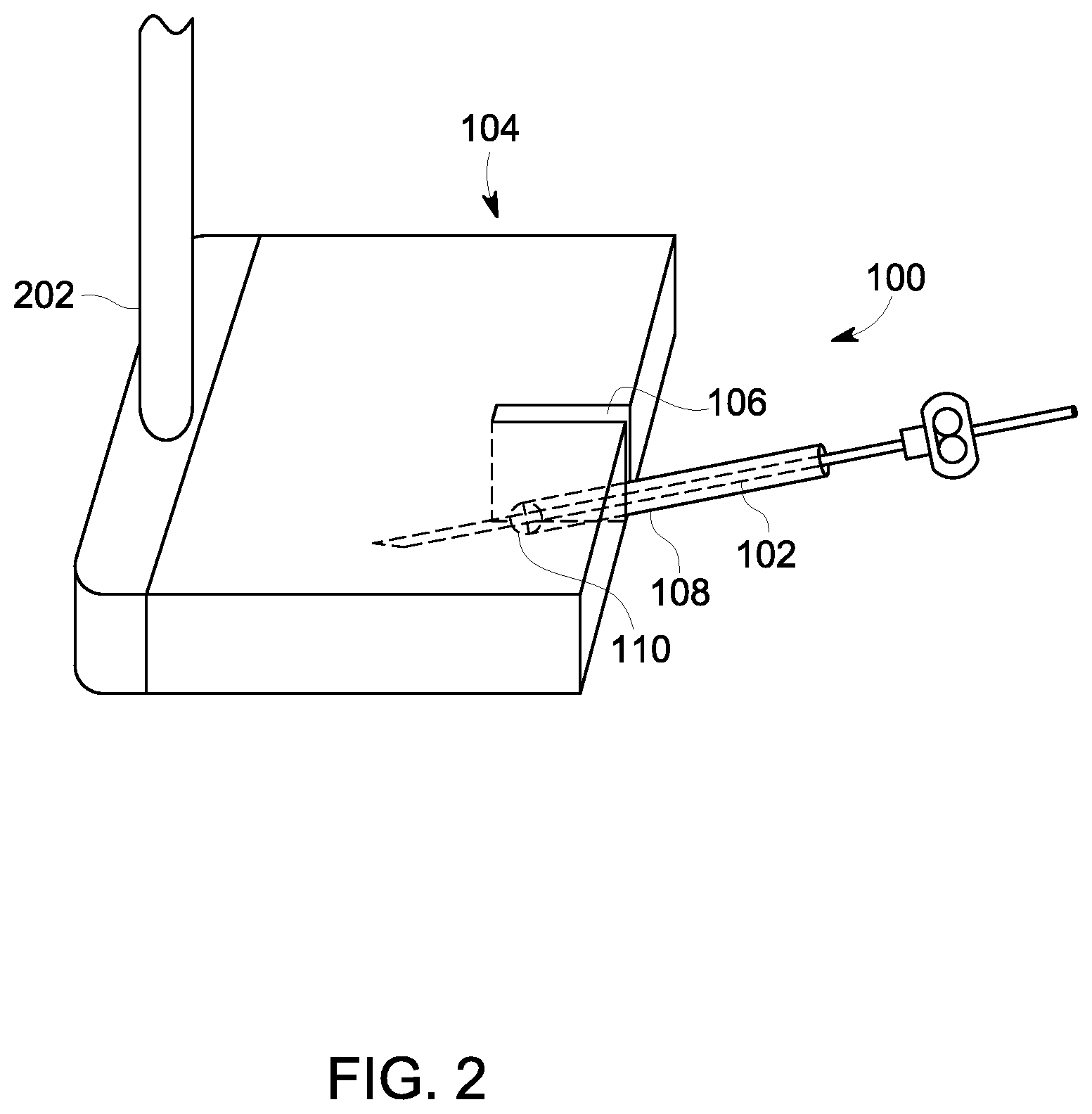 Patent US12303320 Figure 2 – Ultrasound probe with an integrated needle assembly and a computer program product, a method and a system for providing a path for inserting a needle of the ultrasound probe