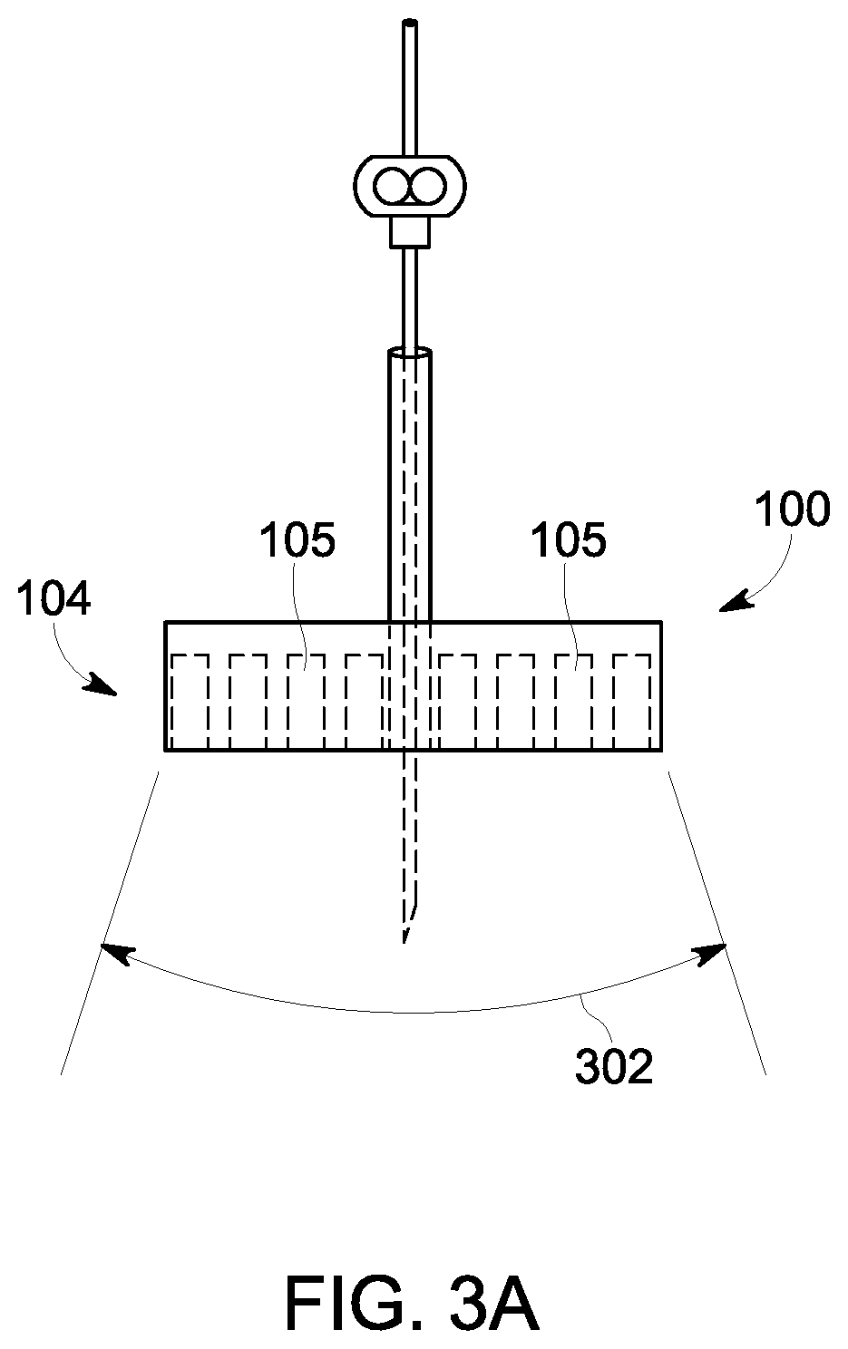 Patent US12303320 Figure 3 – Ultrasound probe with an integrated needle assembly and a computer program product, a method and a system for providing a path for inserting a needle of the ultrasound probe
