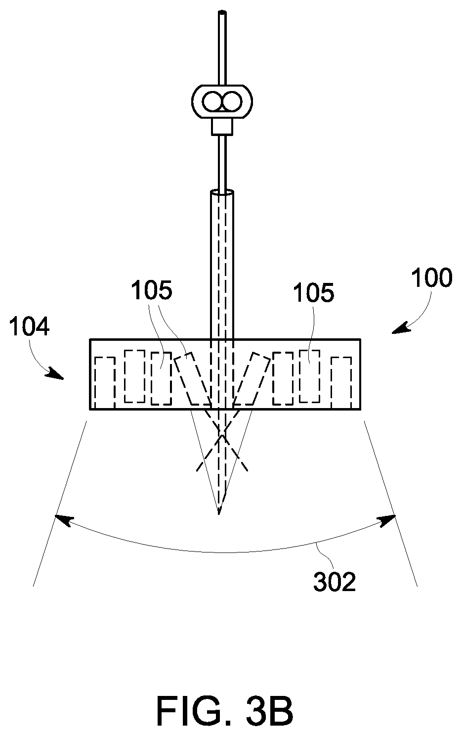 Patent US12303320 Figure 4 – Ultrasound probe with an integrated needle assembly and a computer program product, a method and a system for providing a path for inserting a needle of the ultrasound probe