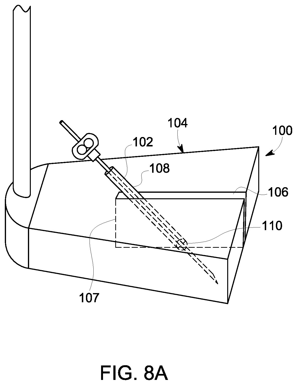 Patent US12303320 Figure 10 – Ultrasound probe with an integrated needle assembly and a computer program product, a method and a system for providing a path for inserting a needle of the ultrasound probe