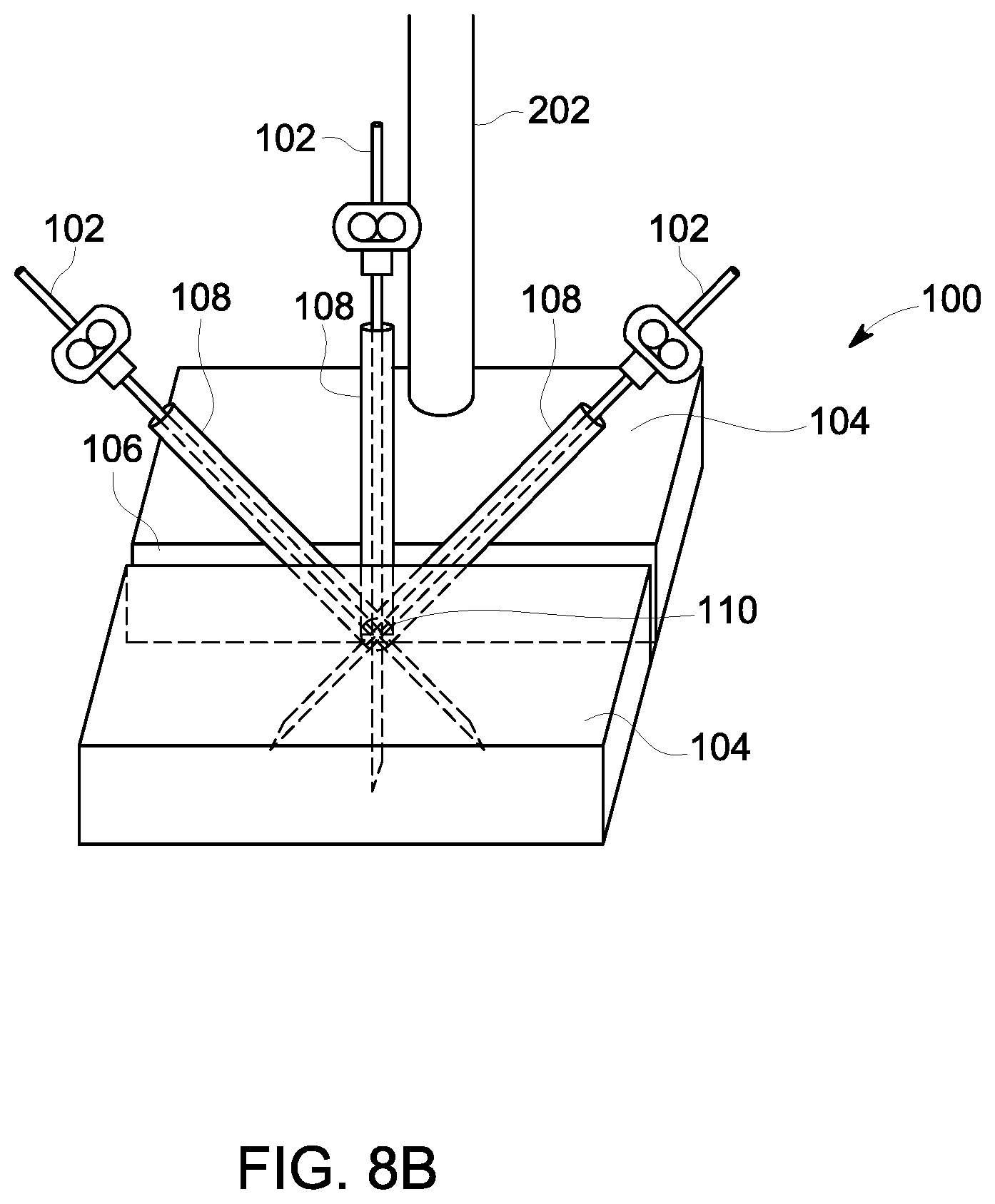 Patent US12303320 Figure 11 – Ultrasound probe with an integrated needle assembly and a computer program product, a method and a system for providing a path for inserting a needle of the ultrasound probe