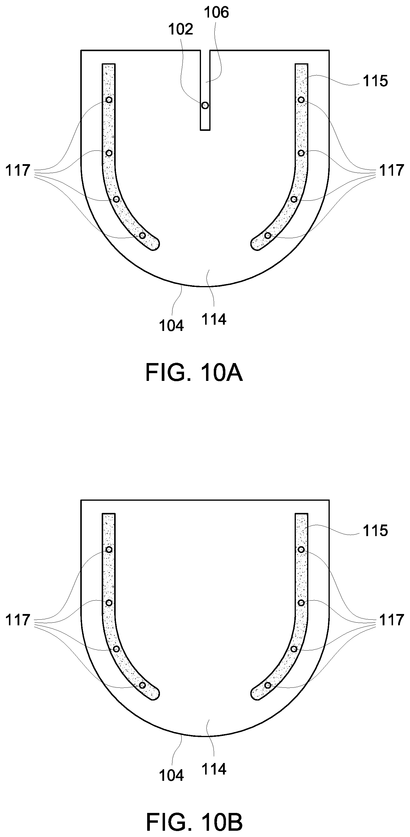 Patent US12303320 Figure 15 – Ultrasound probe with an integrated needle assembly and a computer program product, a method and a system for providing a path for inserting a needle of the ultrasound probe