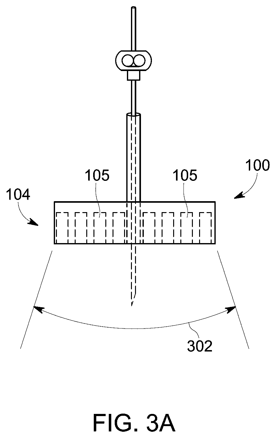 Patent US12303321 Figure 3 – Ultrasound probe with an integrated needle assembly and a computer program product, a method and a system for providing a path for inserting a needle of the ultrasound probe