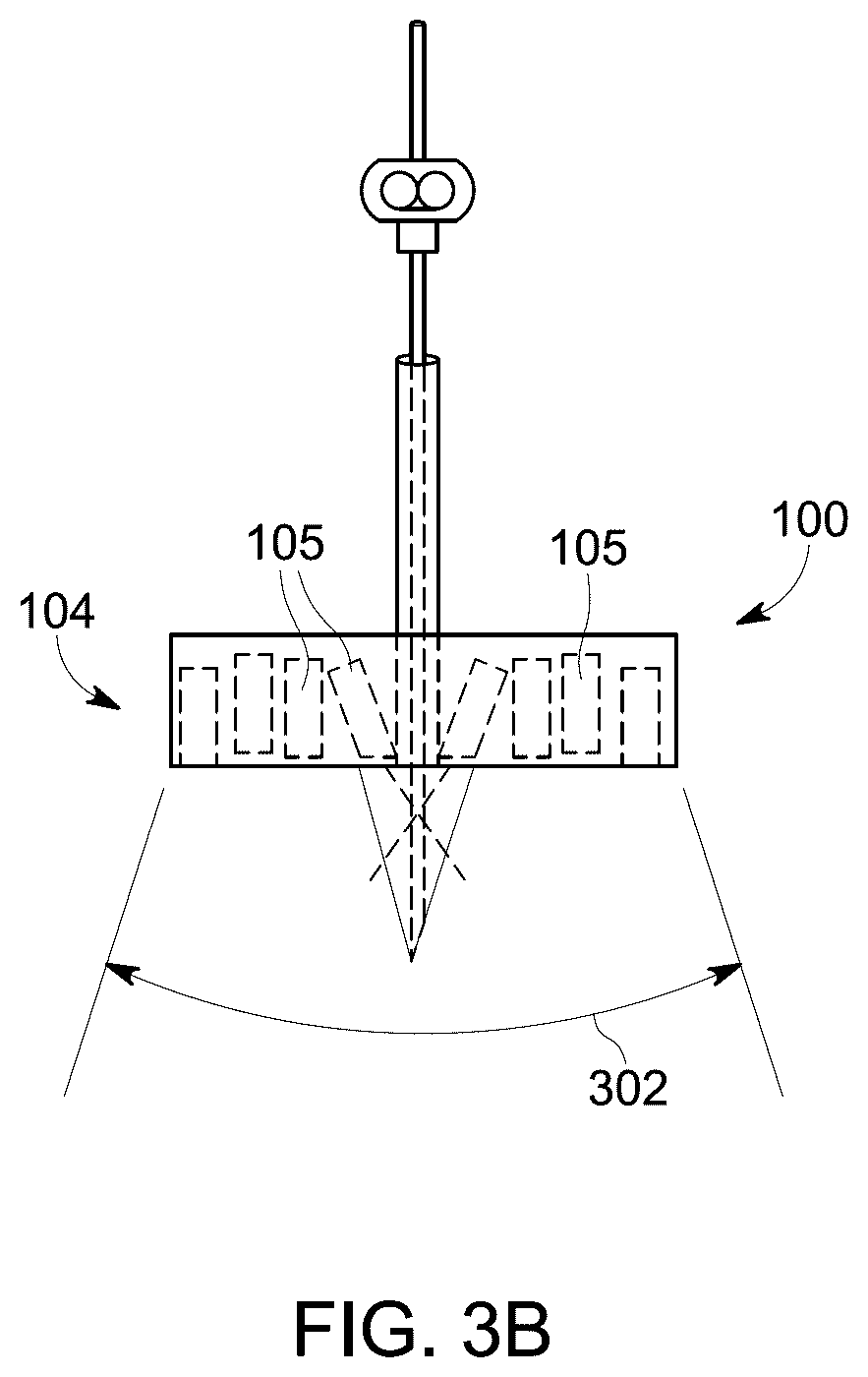 Patent US12303321 Figure 4 – Ultrasound probe with an integrated needle assembly and a computer program product, a method and a system for providing a path for inserting a needle of the ultrasound probe