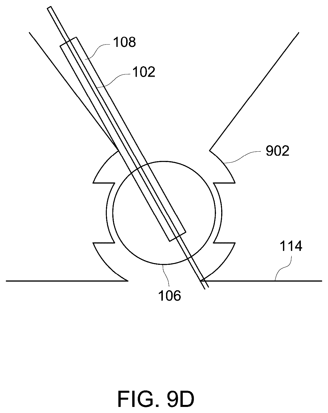 Patent US12303321 Figure 14 – Ultrasound probe with an integrated needle assembly and a computer program product, a method and a system for providing a path for inserting a needle of the ultrasound probe