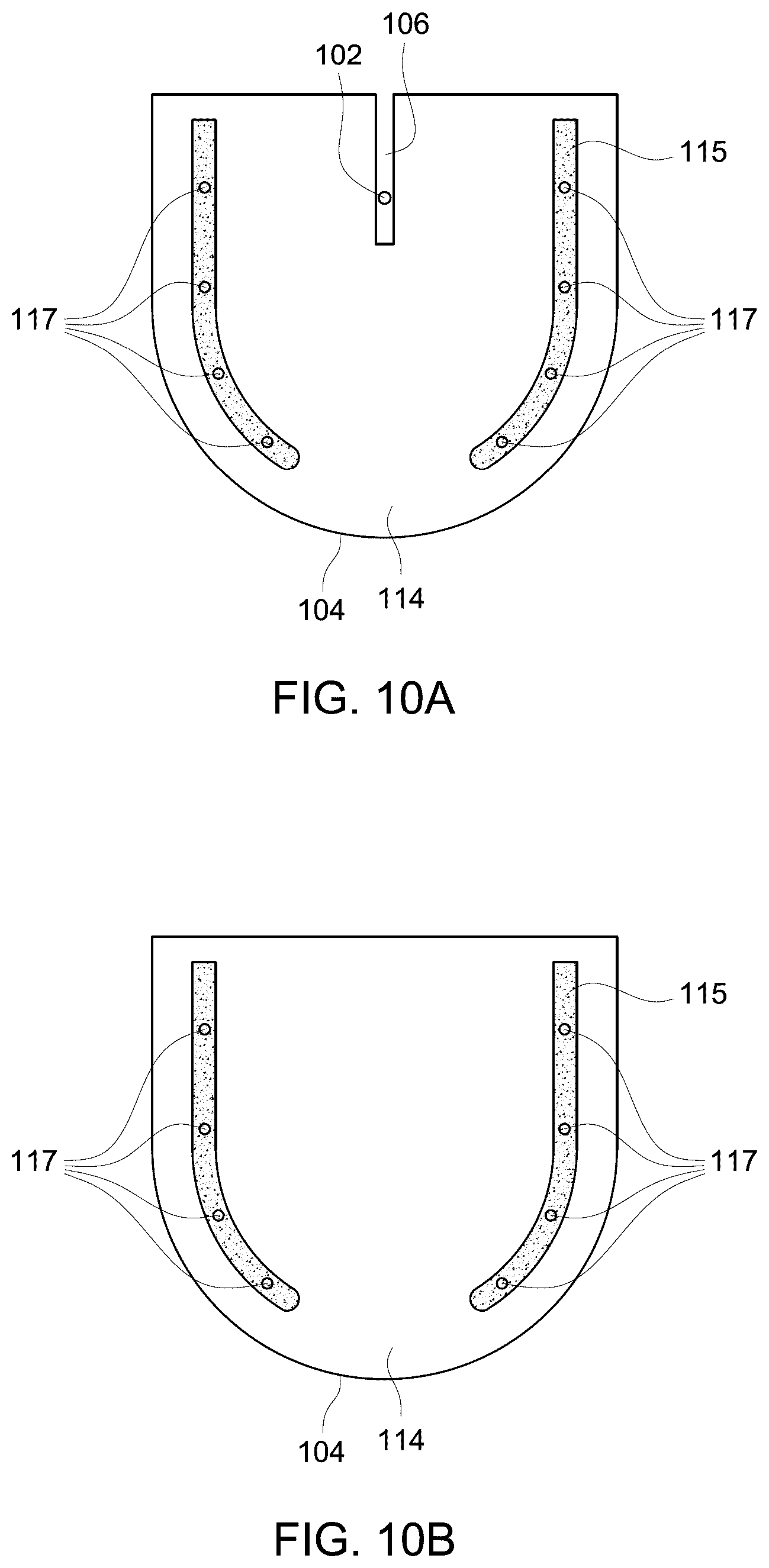 Patent US12303321 Figure 15 – Ultrasound probe with an integrated needle assembly and a computer program product, a method and a system for providing a path for inserting a needle of the ultrasound probe