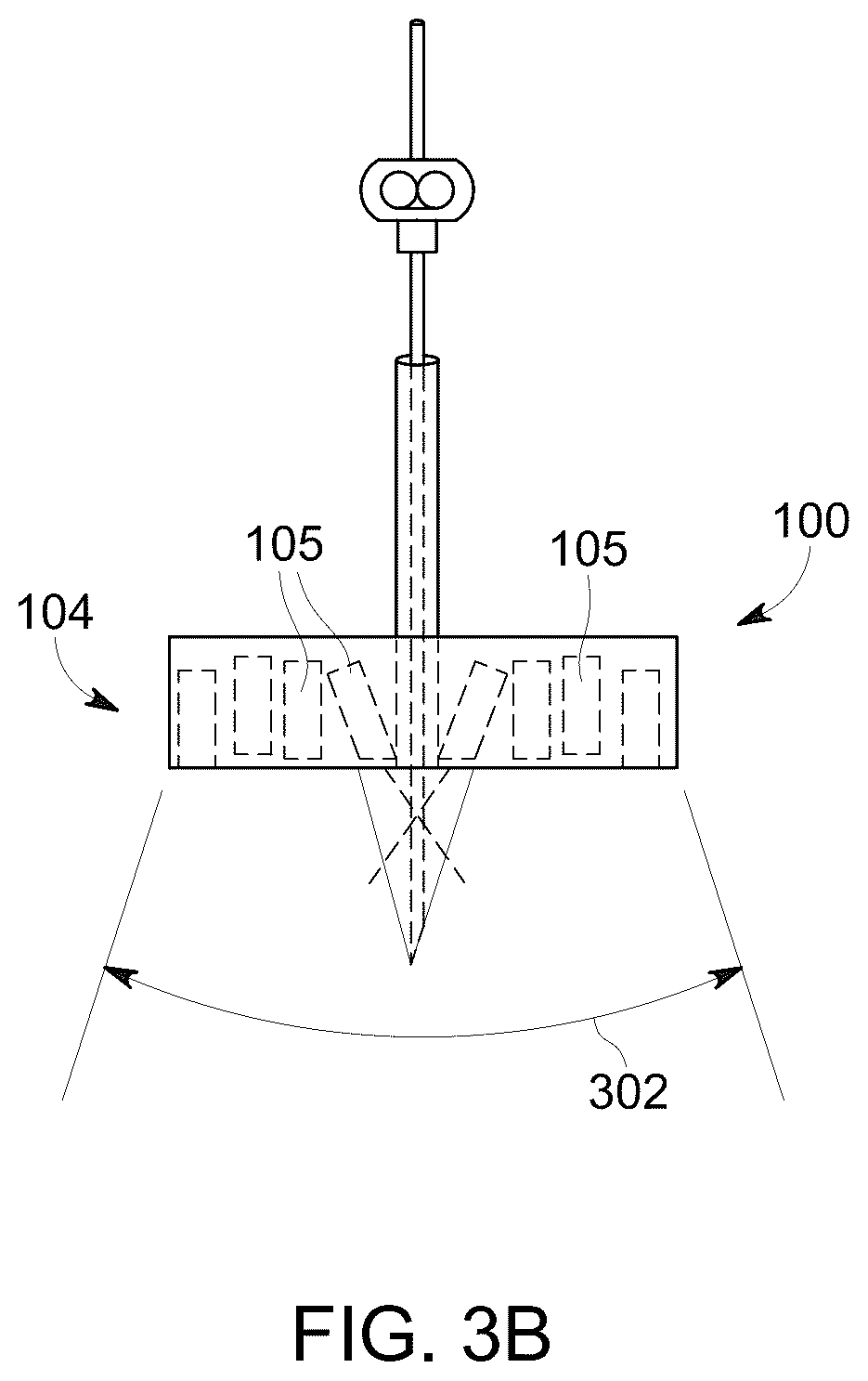 Patent US12303322 Figure 4 – Ultrasound probe with an integrated needle assembly and a computer program product, a method and a system for providing a path for inserting a needle of the ultrasound probe