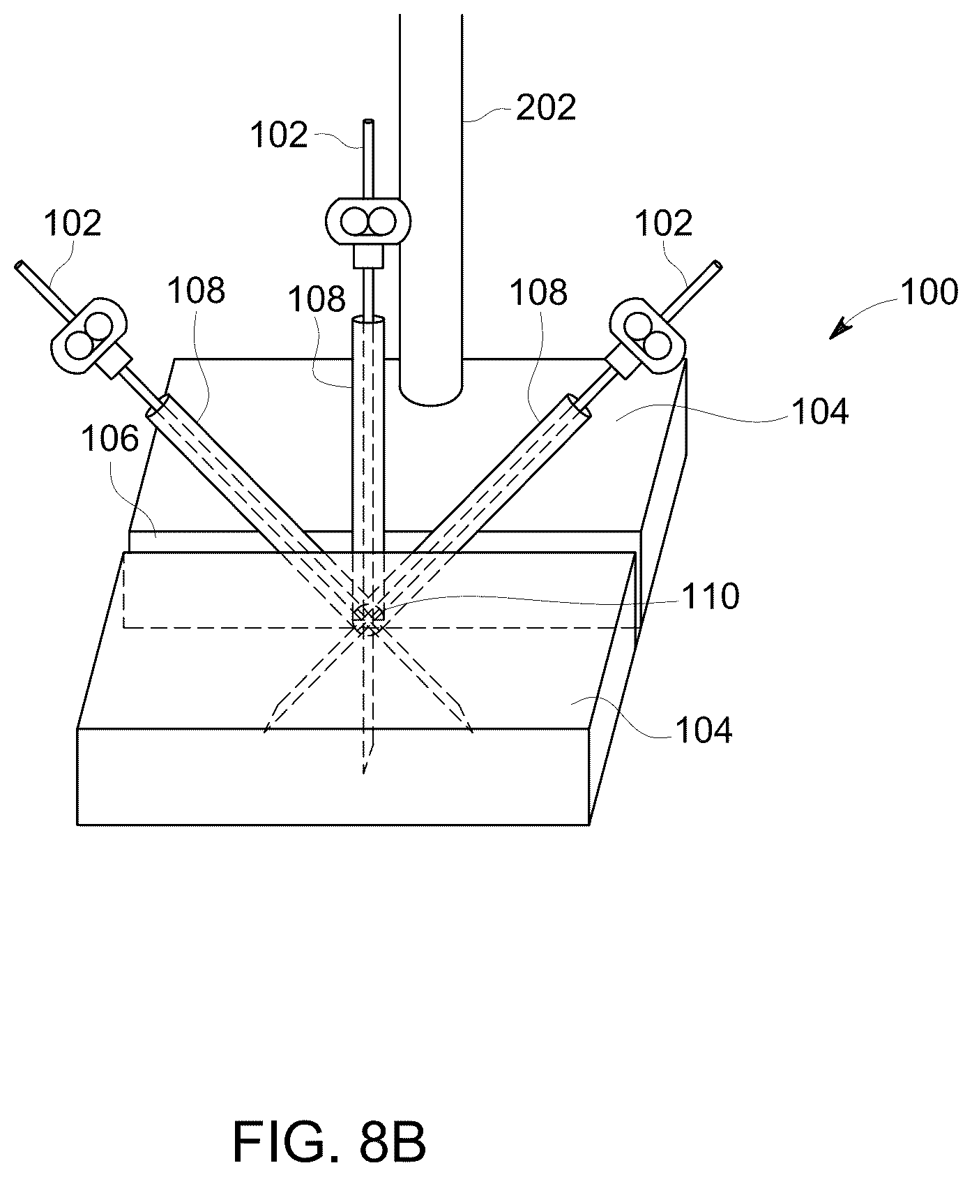 Patent US12303322 Figure 11 – Ultrasound probe with an integrated needle assembly and a computer program product, a method and a system for providing a path for inserting a needle of the ultrasound probe