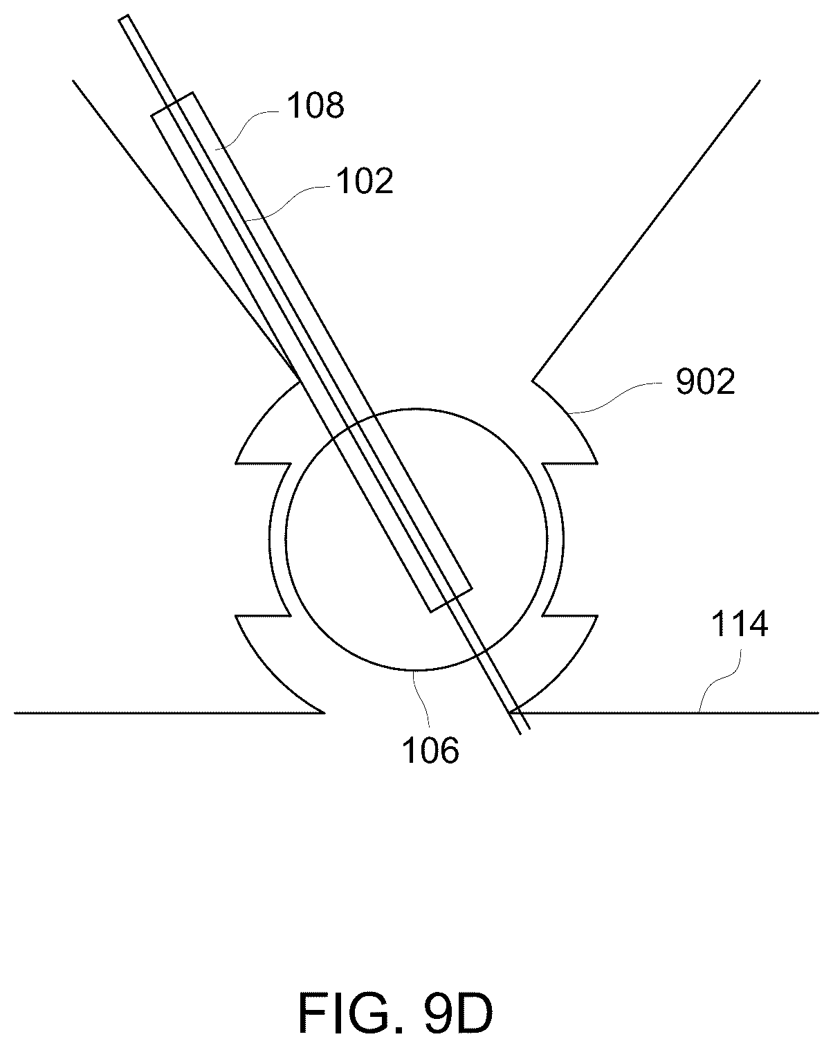 Patent US12303322 Figure 14 – Ultrasound probe with an integrated needle assembly and a computer program product, a method and a system for providing a path for inserting a needle of the ultrasound probe