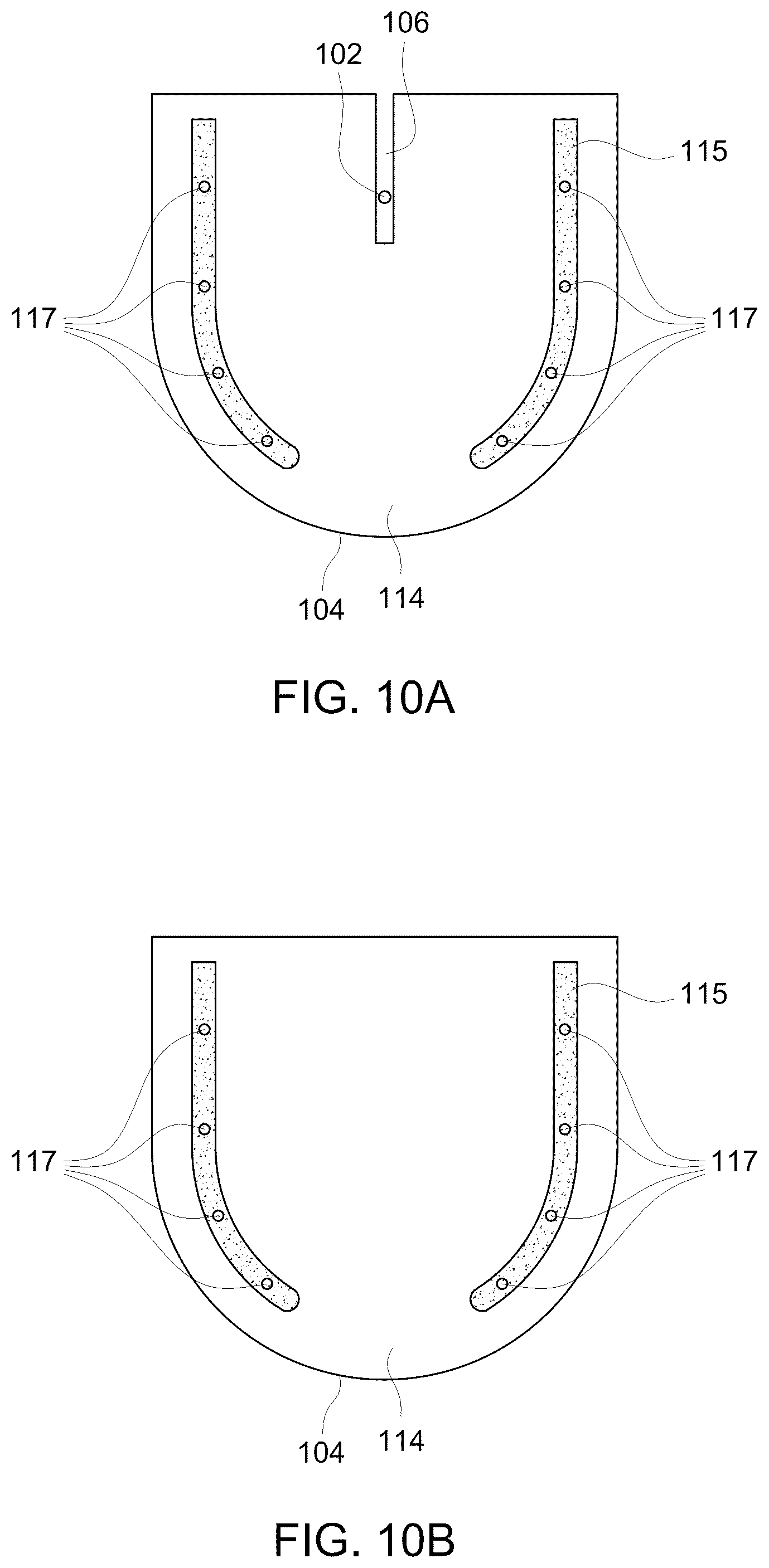 Patent US12303322 Figure 15 – Ultrasound probe with an integrated needle assembly and a computer program product, a method and a system for providing a path for inserting a needle of the ultrasound probe