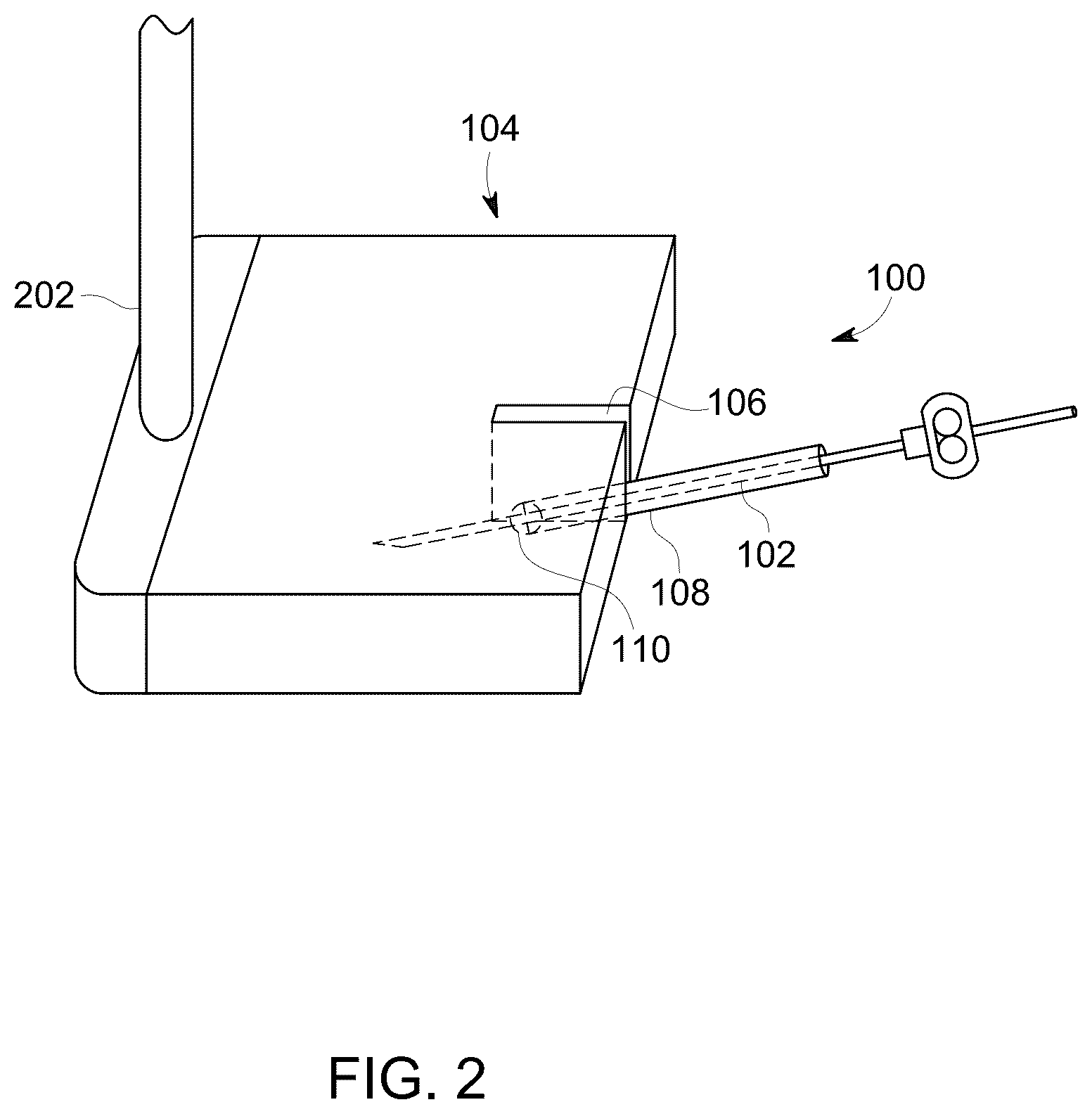 Patent US12303323 Figure 2 – Ultrasound probe with an integrated needle assembly and a computer program product, a method and a system for providing a path for inserting a needle of the ultrasound probe