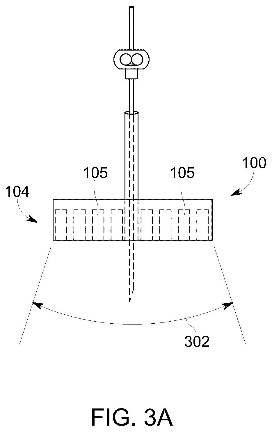 Patent US12303323 Figure 3 – Ultrasound probe with an integrated needle assembly and a computer program product, a method and a system for providing a path for inserting a needle of the ultrasound probe