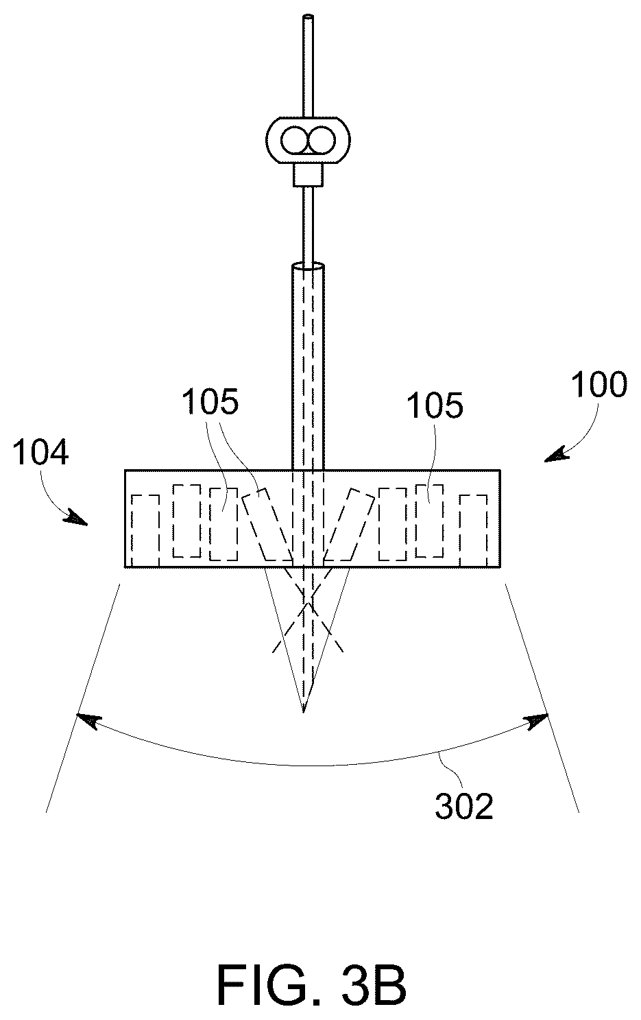 Patent US12303323 Figure 4 – Ultrasound probe with an integrated needle assembly and a computer program product, a method and a system for providing a path for inserting a needle of the ultrasound probe