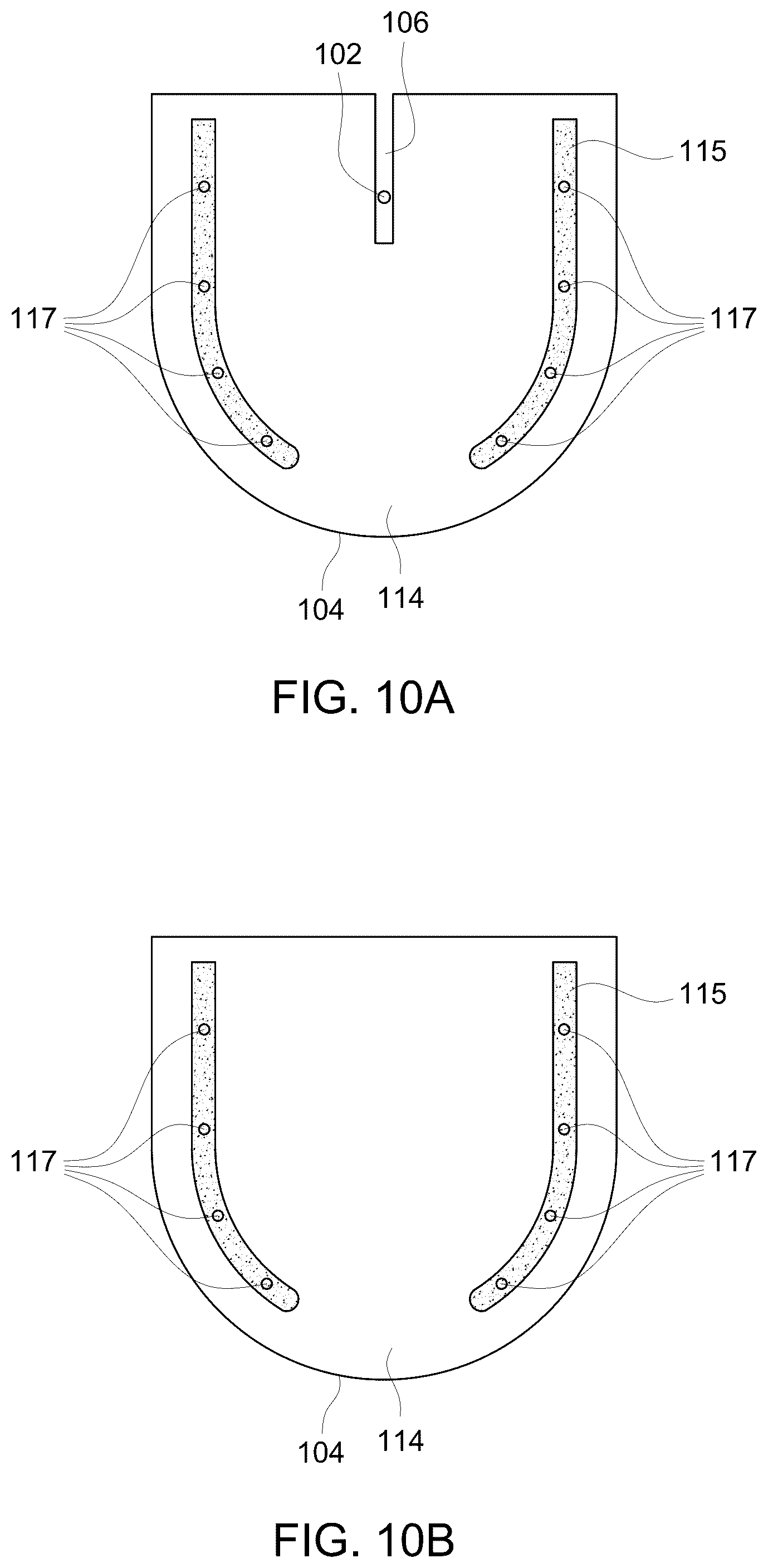 Patent US12303323 Figure 15 – Ultrasound probe with an integrated needle assembly and a computer program product, a method and a system for providing a path for inserting a needle of the ultrasound probe