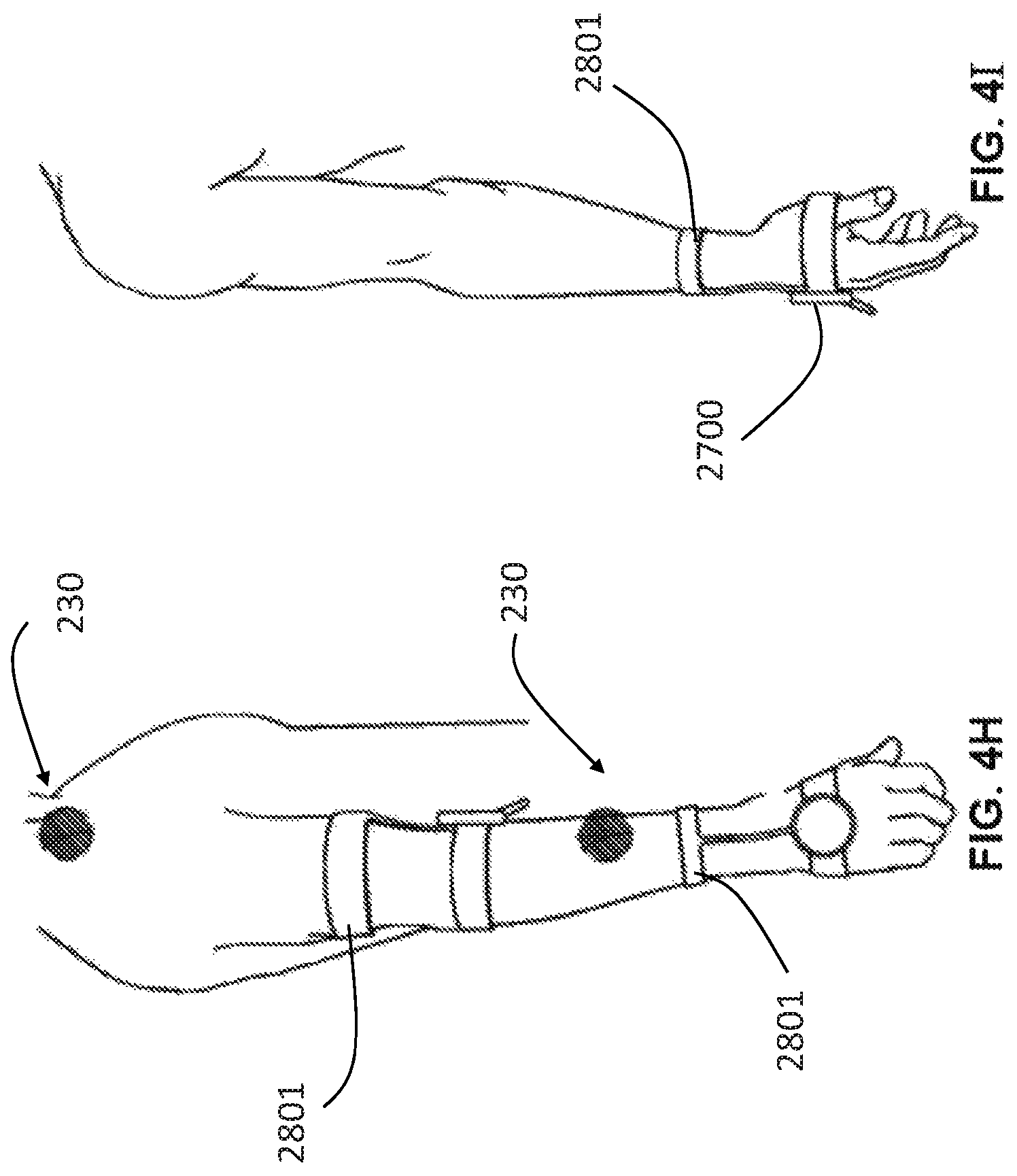 Patent US12303324 Figure 9 – Method of medical imaging using multiple arrays