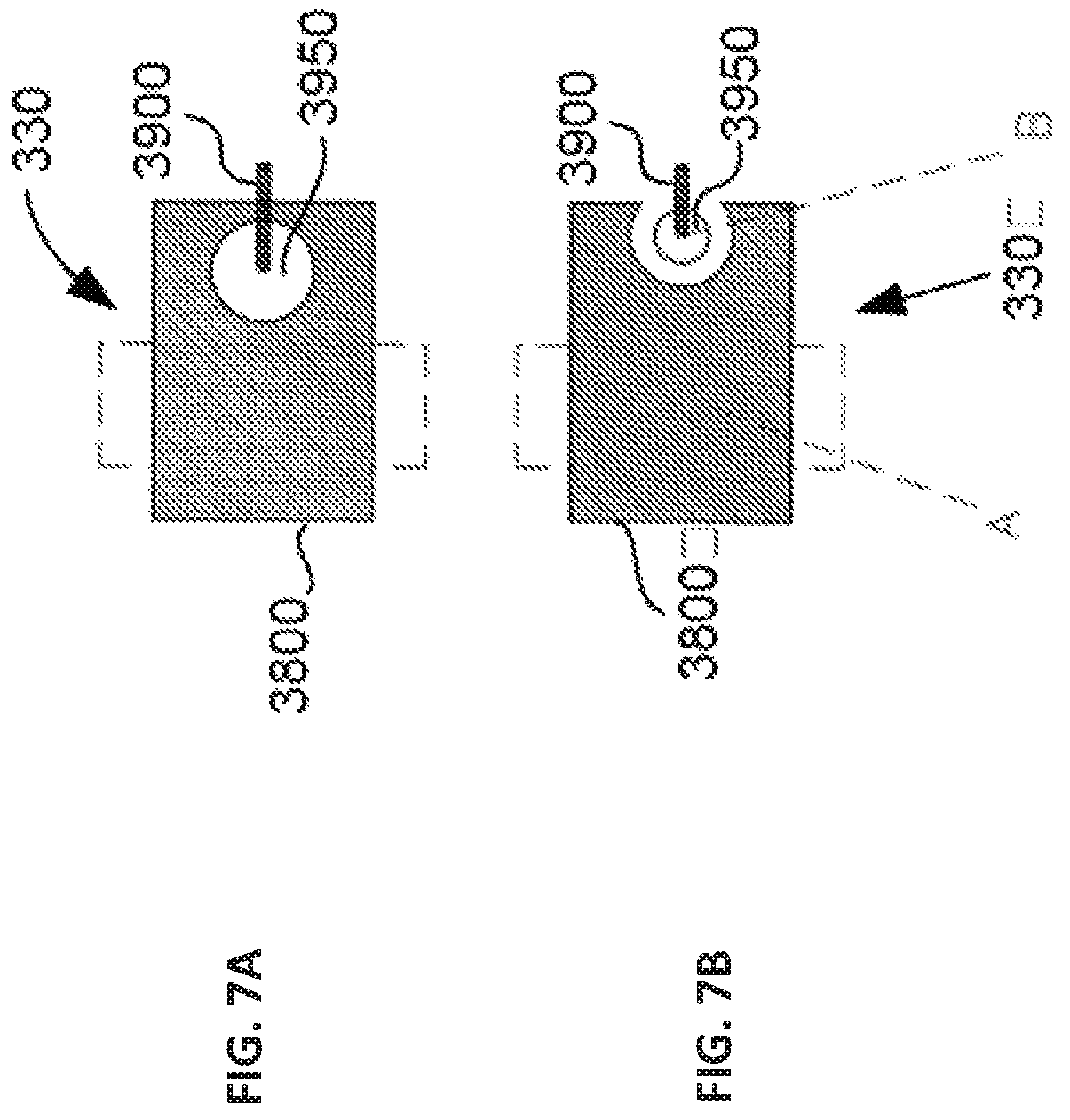 Patent US12303324 Figure 12 – Method of medical imaging using multiple arrays