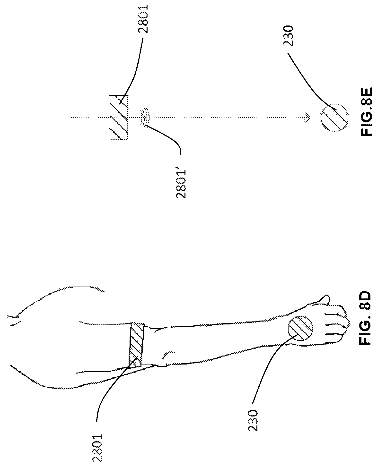 Patent US12303324 Figure 15 – Method of medical imaging using multiple arrays