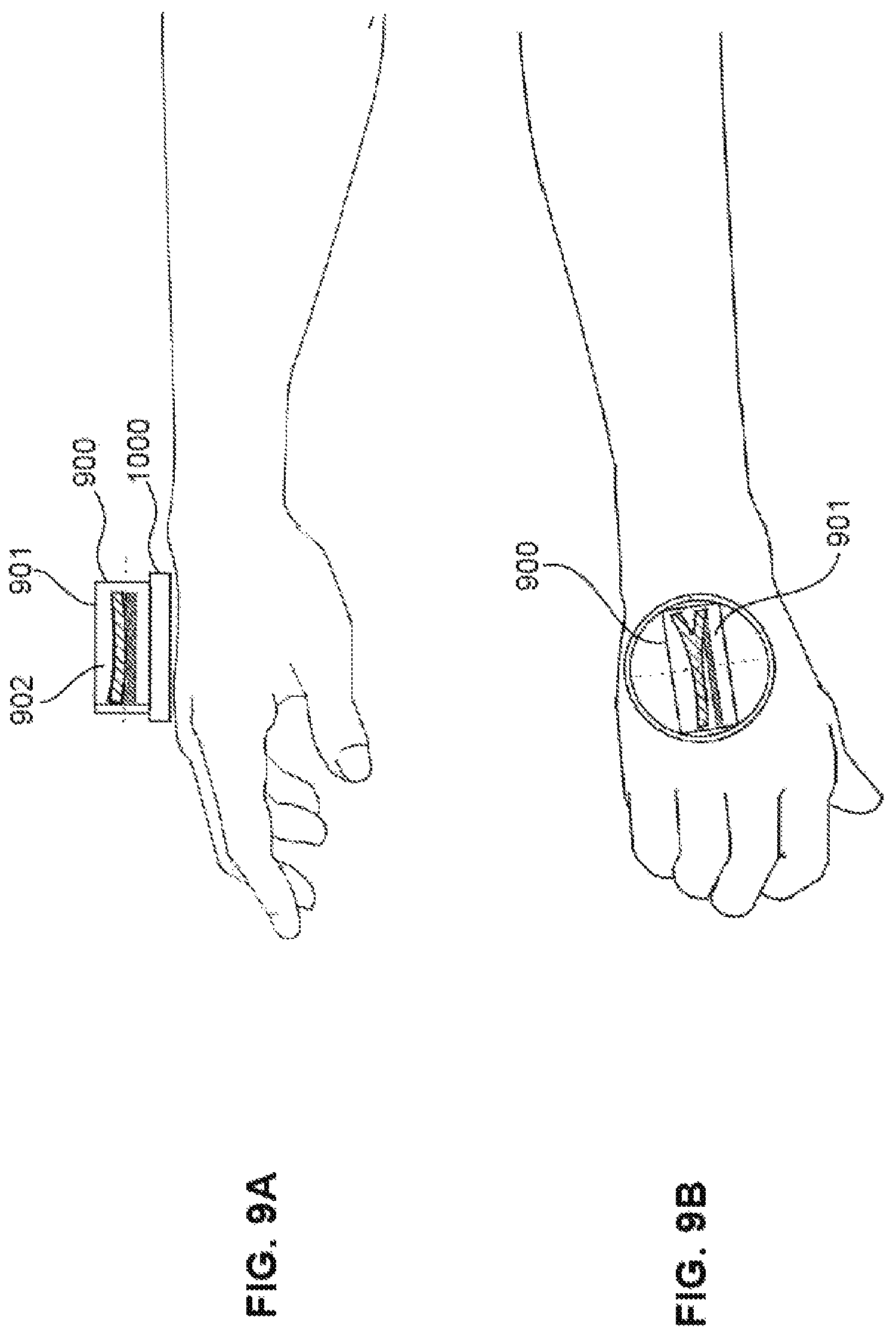 Patent US12303324 Figure 16 – Method of medical imaging using multiple arrays