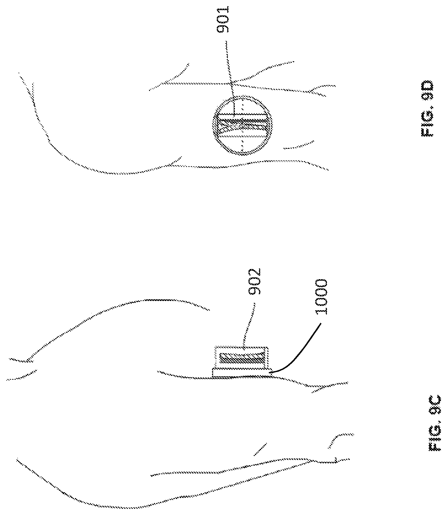Patent US12303324 Figure 17 – Method of medical imaging using multiple arrays