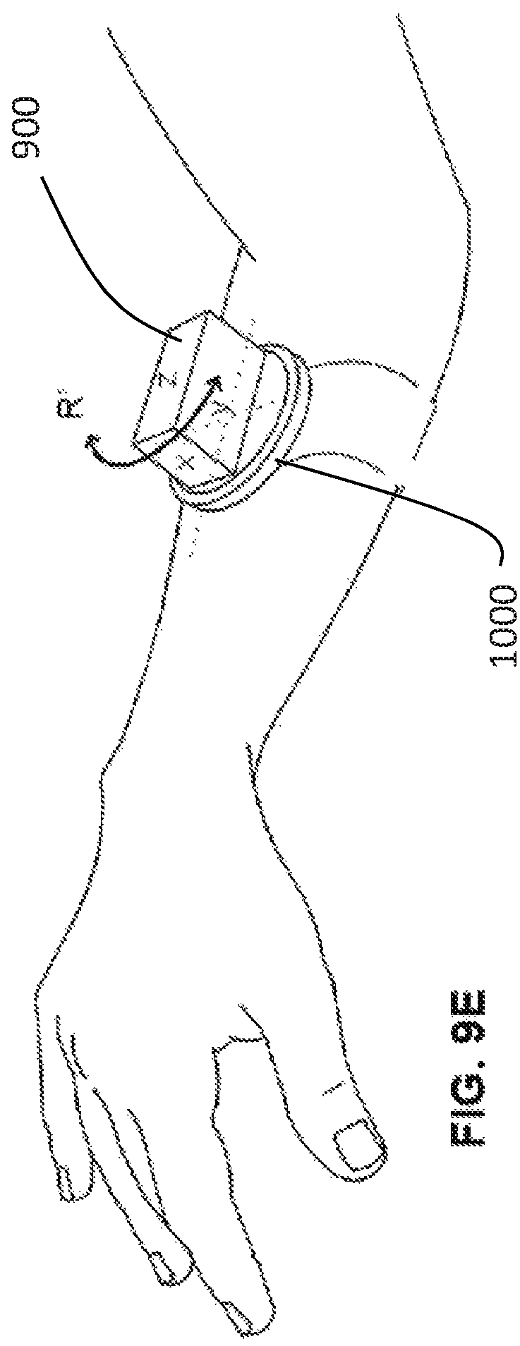 Patent US12303324 Figure 18 – Method of medical imaging using multiple arrays